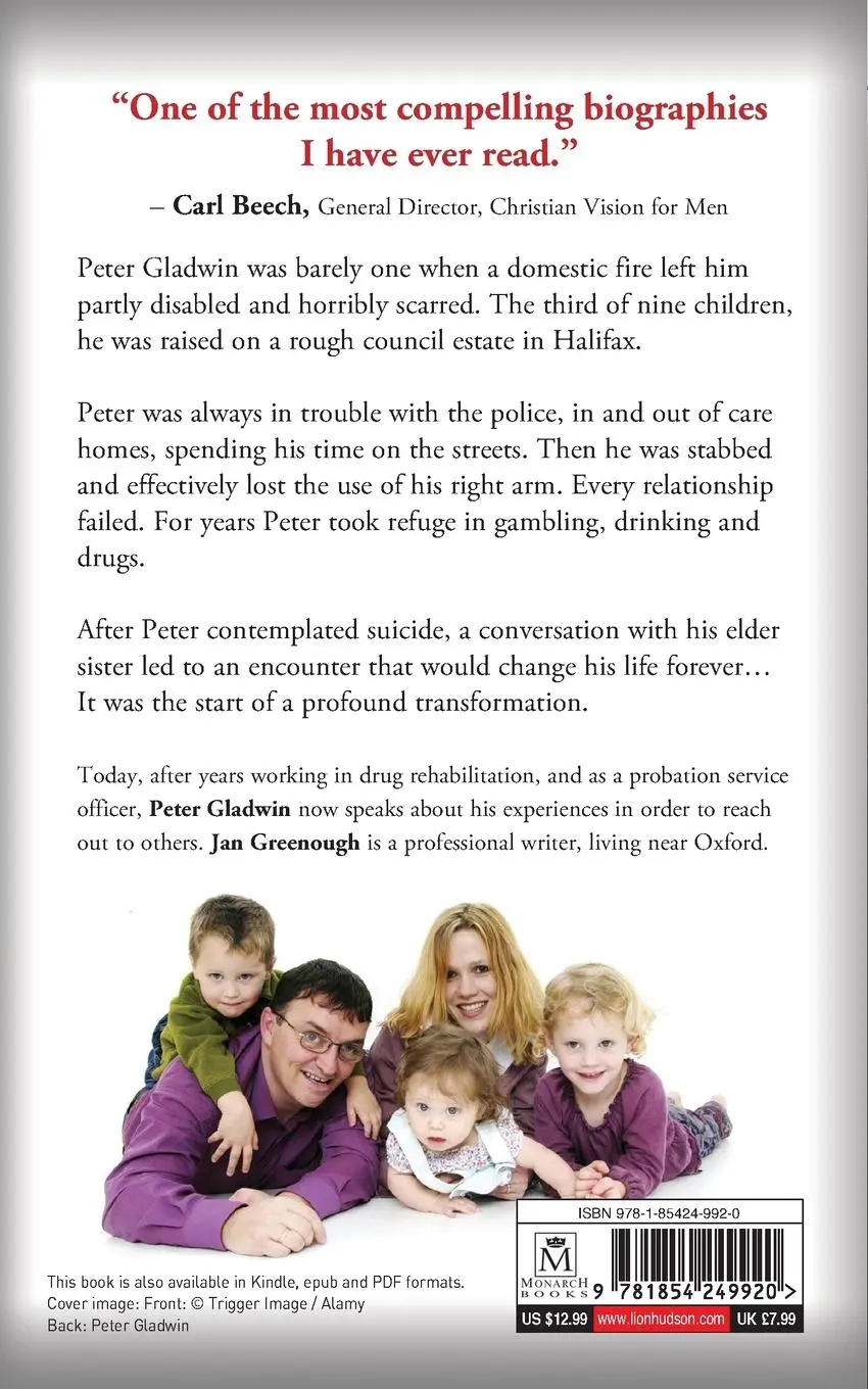 Rückseite: 9781854249920 | Out of the Ashes | The Restoration of a Burned Boy | Peter Gladwin