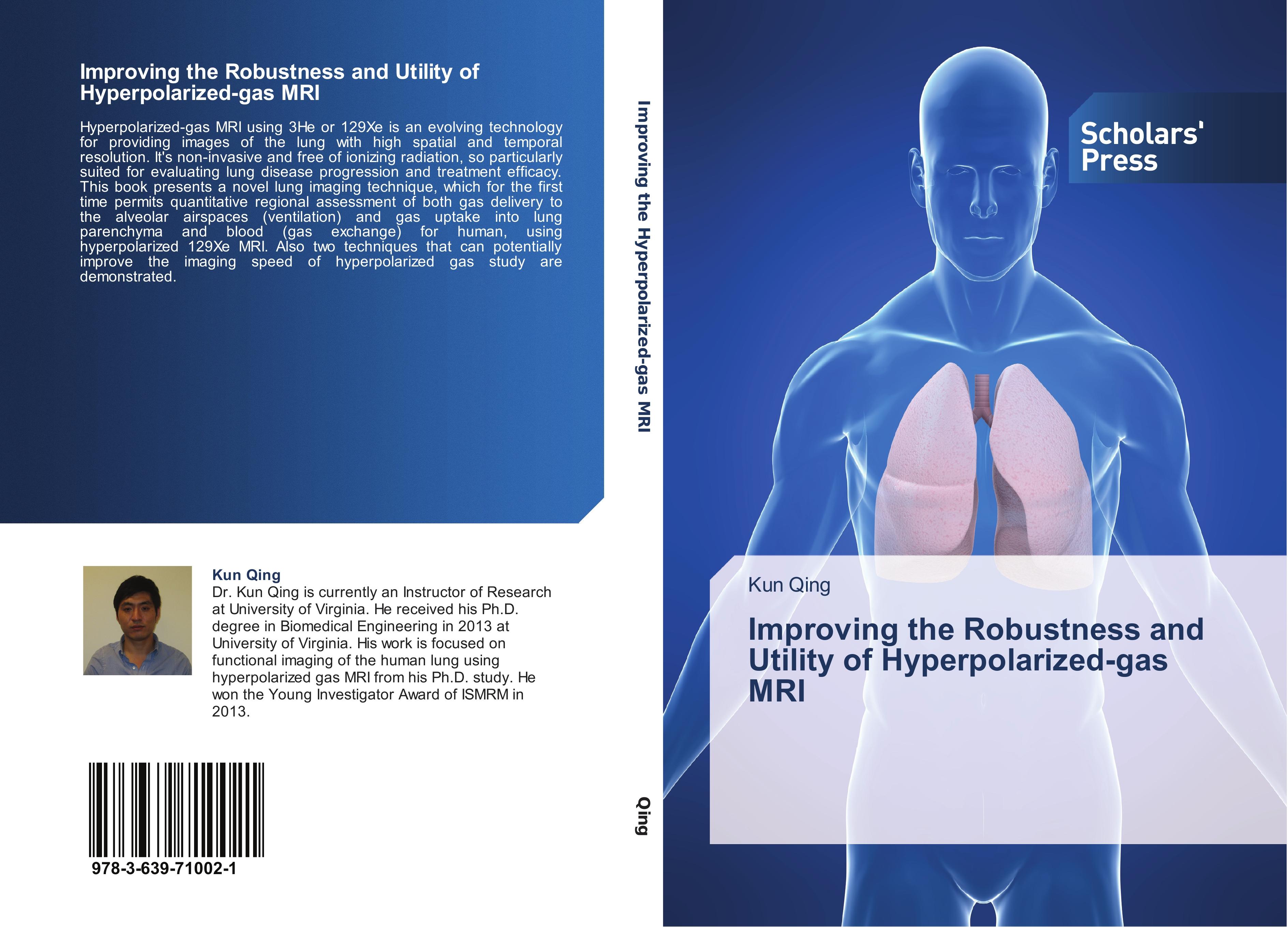Improving the Robustness and Utility of Hyperpolarized-gas MRI | Kun Qing | Taschenbuch | Paperback | 160 S. | Englisch | 2014 | Scholars' Press | EAN 9783639710021 - Qing, Kun
