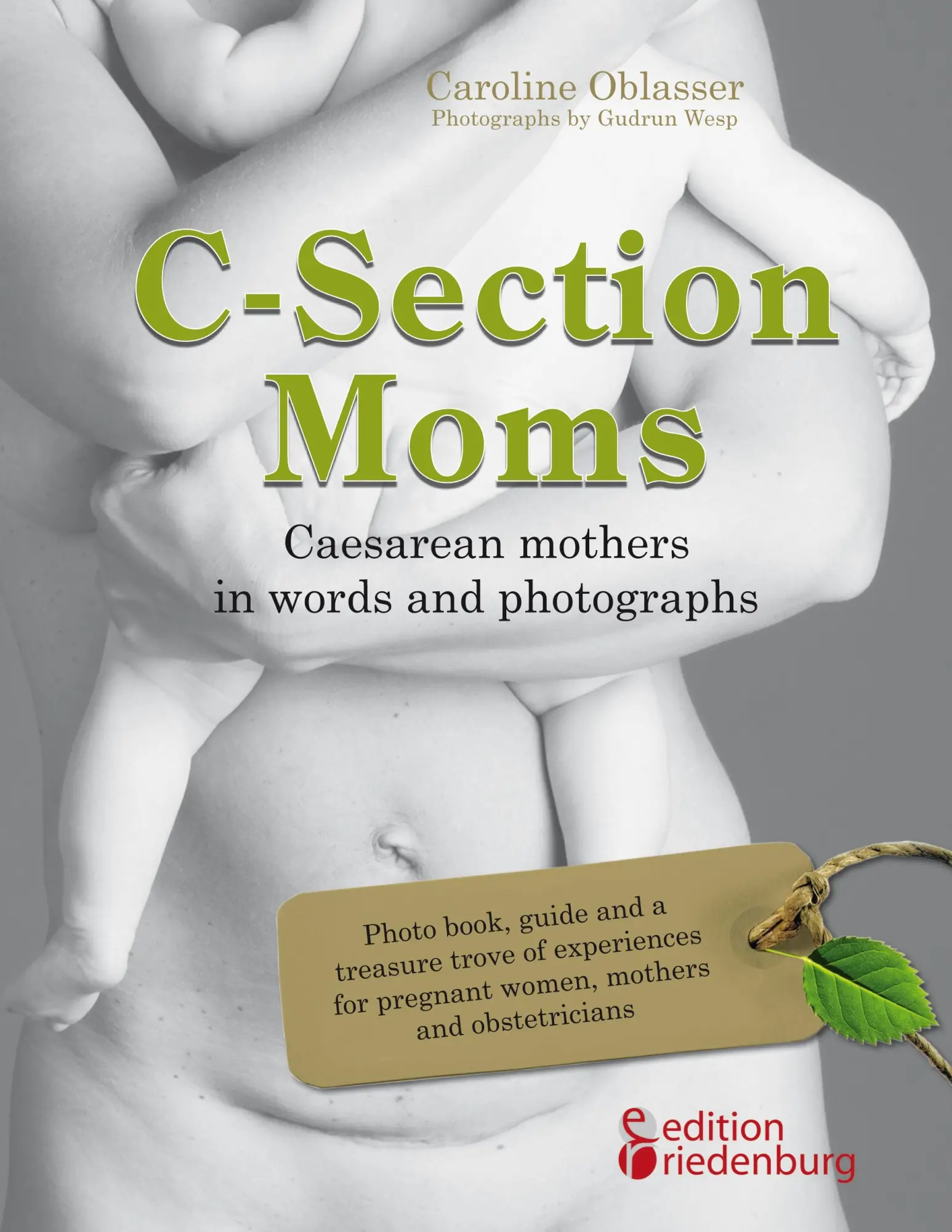 Cover: 9783902943521 | C-Section Moms - Caesarean mothers in words and photographs | Oblasser