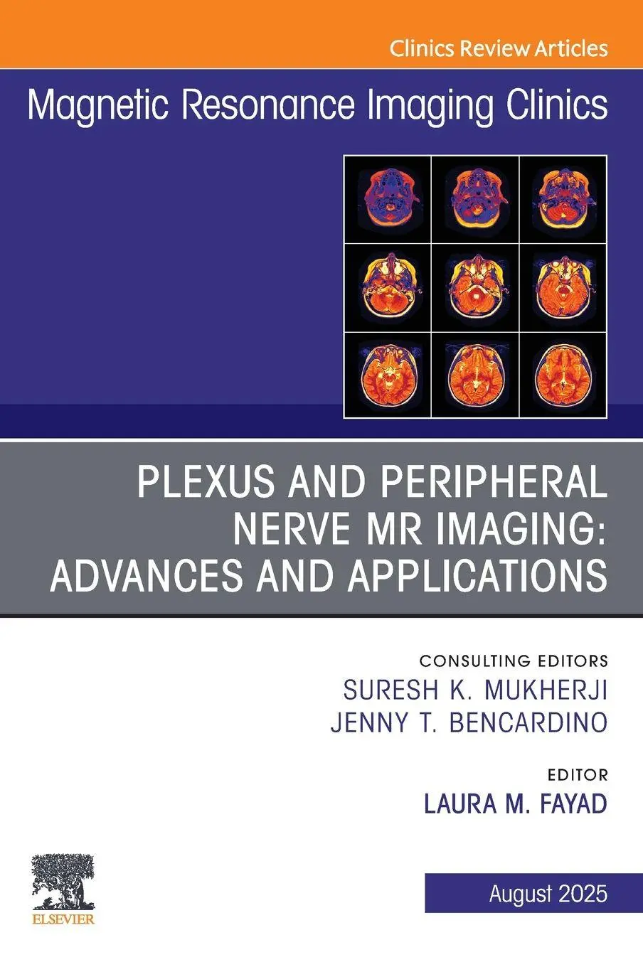 Cover: 9780443313721 | Plexus and Peripheral Nerve MR Imaging: Advances and Applications,...
