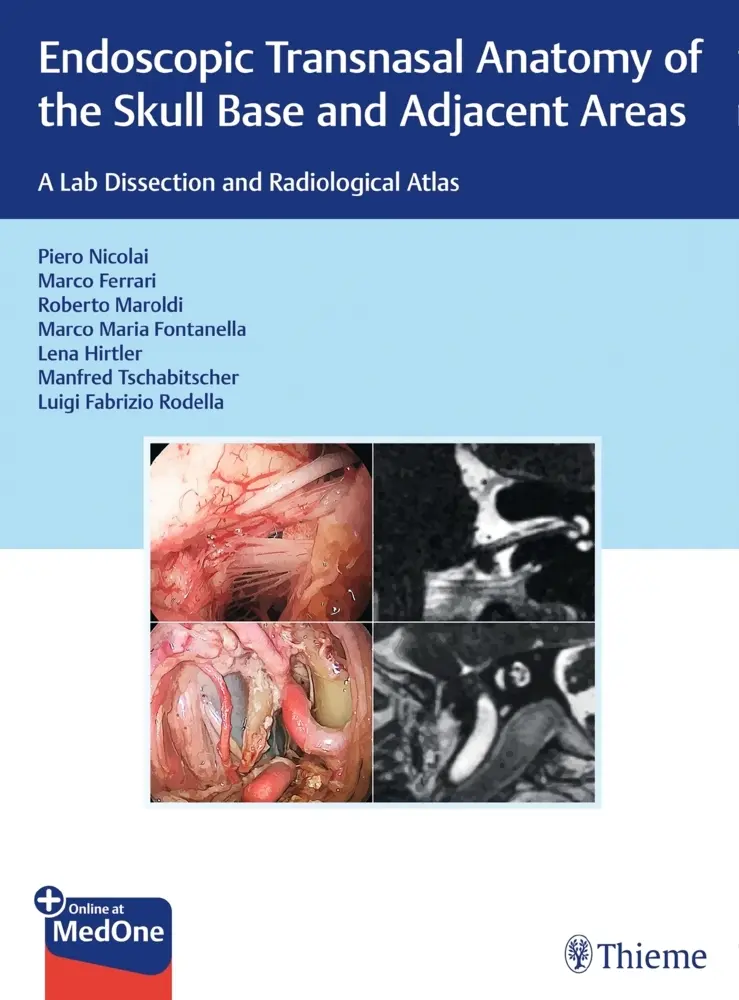 Cover: 9783132415621 | Endoscopic Transnasal Anatomy of the Skull Base and Adjacent Areas