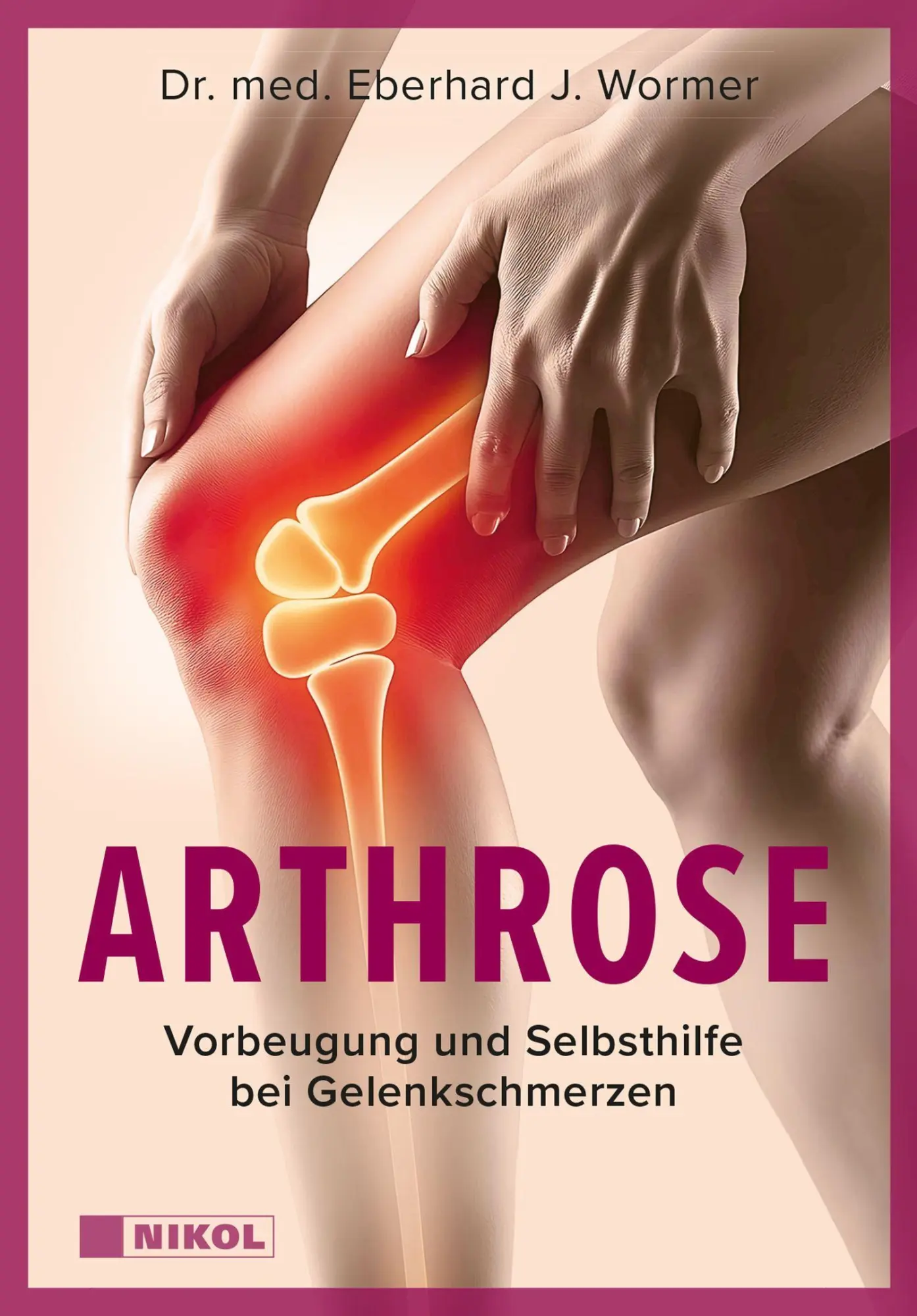 Cover: 9783690430722 | Arthrose: Vorbeugung und Selbsthilfe bei Gelenkschmerzen | Wormer