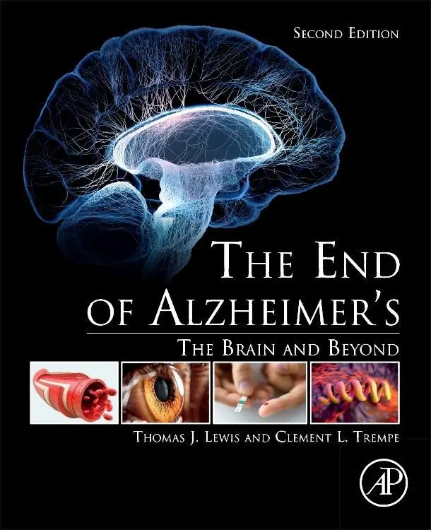 Cover: 9780128121122 | The End of Alzheimer's | The Brain and Beyond | Thomas J Lewis (u. a.)