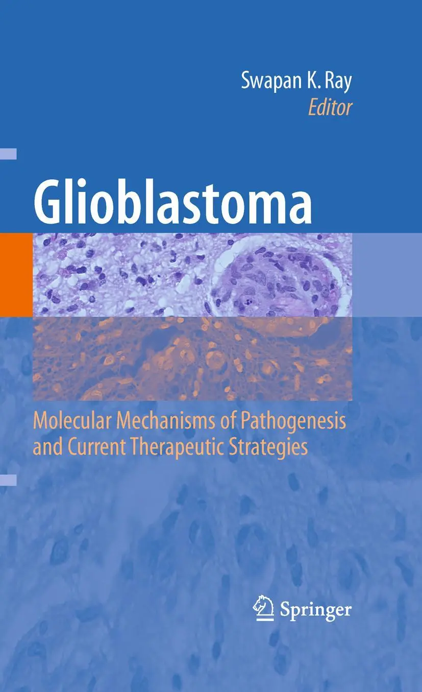 Cover: 9781489981622 | Glioblastoma: | Swapan K. Ray | Taschenbuch | xi | Englisch | 2014
