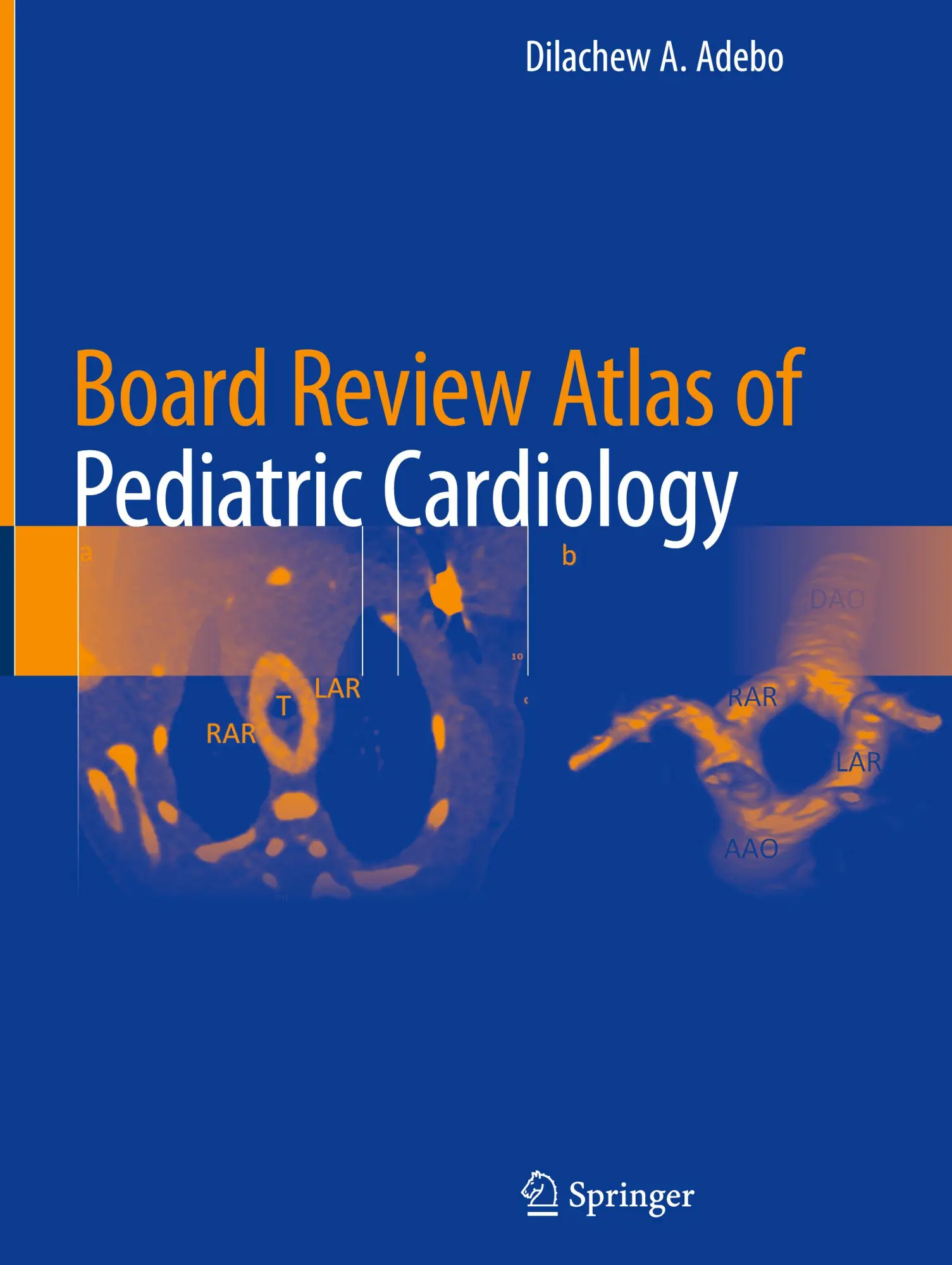 Cover: 9783031594922 | Board Review Atlas of Pediatric Cardiology | Dilachew A. Adebo | Buch