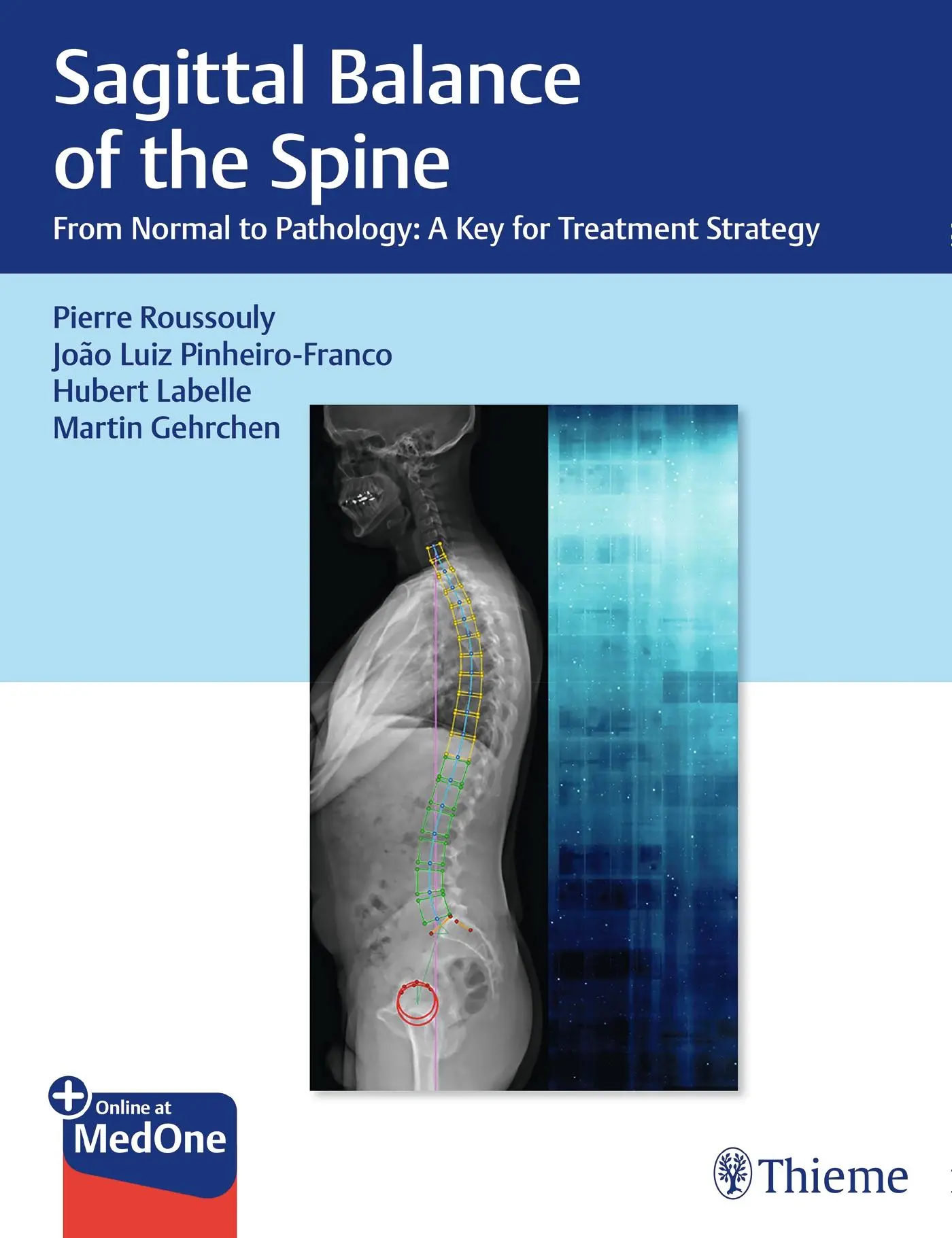 Cover: 9781626237322 | Sagittal Balance of the Spine | Pierre Roussouly (u. a.) | Buch | 2019