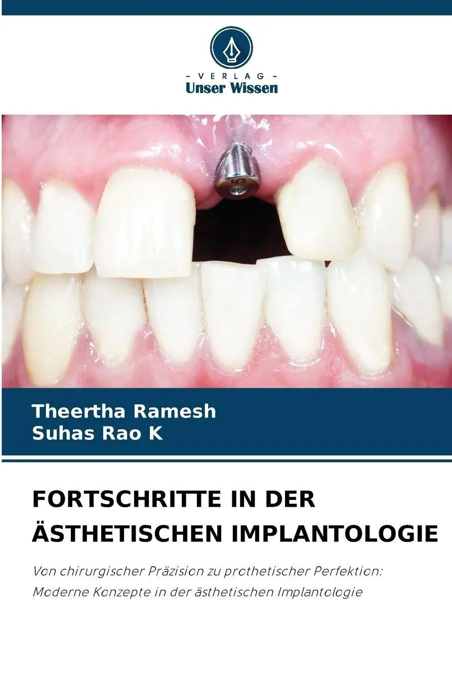Cover: 9786209828522 | FORTSCHRITTE IN DER ÄSTHETISCHEN IMPLANTOLOGIE | Ramesh (u. a.) | Buch
