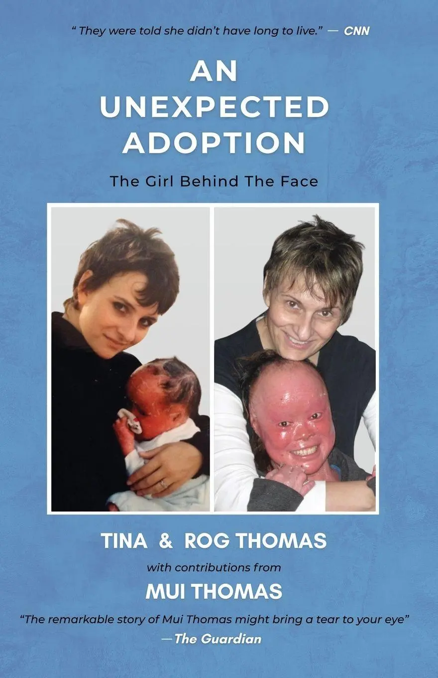 Cover: 9789811781223 | An Unexpected Adoption | The Girl Behind The Face | Tina Rog Thomas