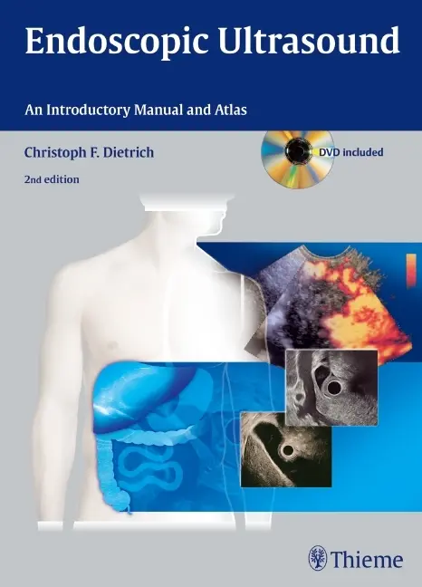 Cover: 9783131431523 | Endoscopic Ultrasound, w. DVD-ROM | An Introductory Manual and Atlas
