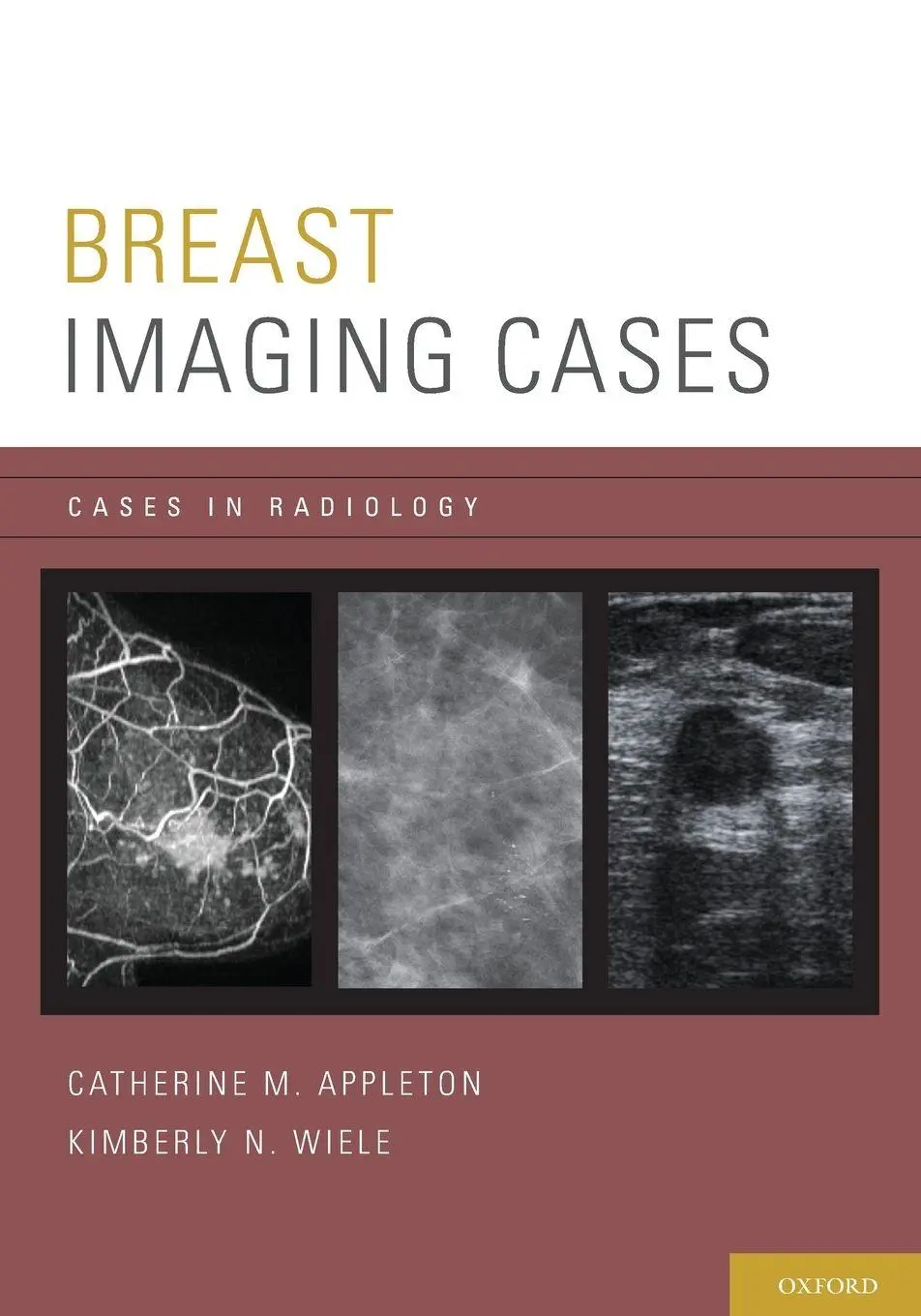 Cover: 9780199731923 | BREAST IMAGING CASES CASRAD P | Appleton | Taschenbuch | Englisch