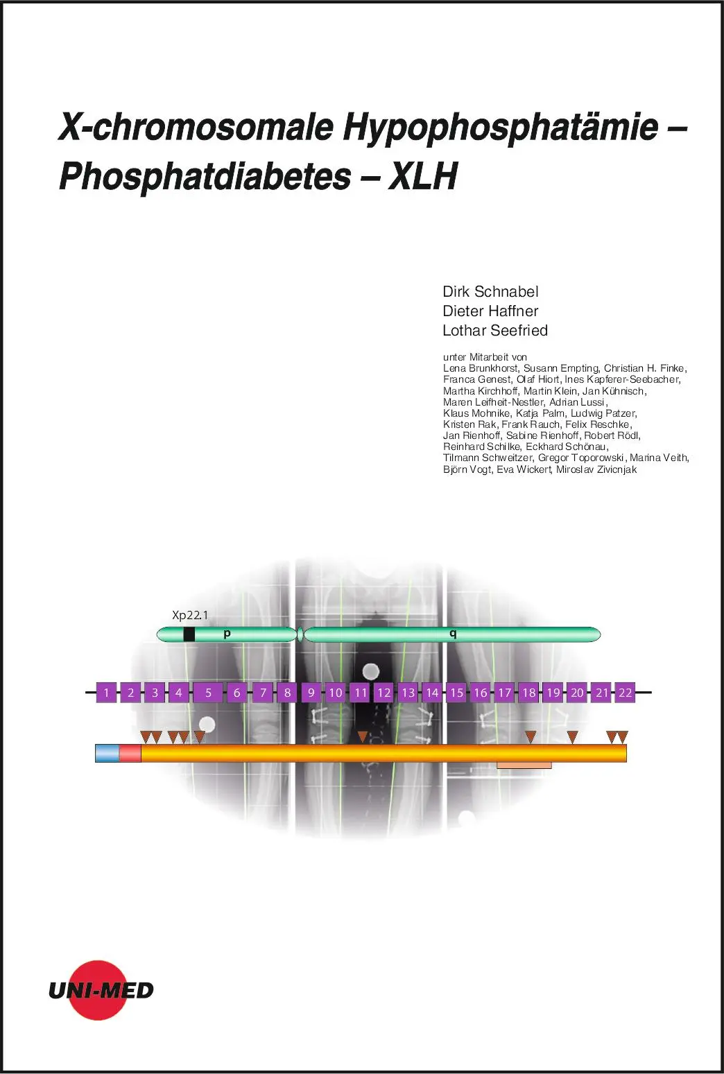 Cover: 9783837424423 | X-chromosomale Hypophosphatämie - Phosphatdiabetes - XLH | Buch | 2022