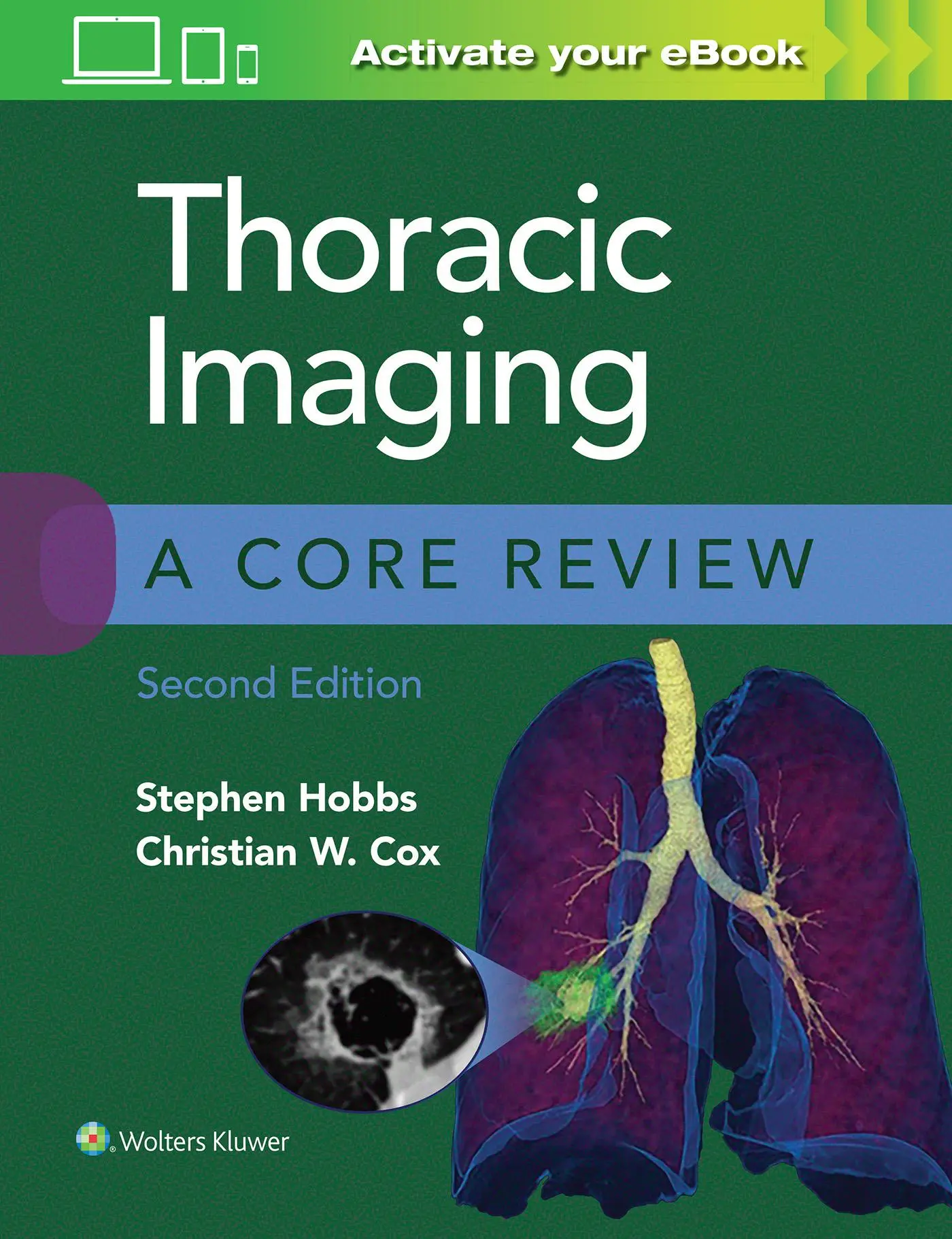 Cover: 9781975126223 | Thoracic Imaging: A Core Review | Christian Cox (u. a.) | Taschenbuch