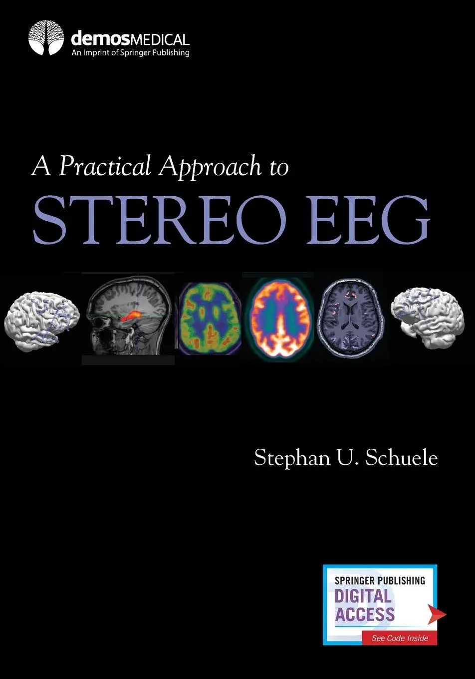 Cover: 9780826136923 | A Practical Approach to Stereo EEG | Stephan U. MD MPH Schuele | Buch