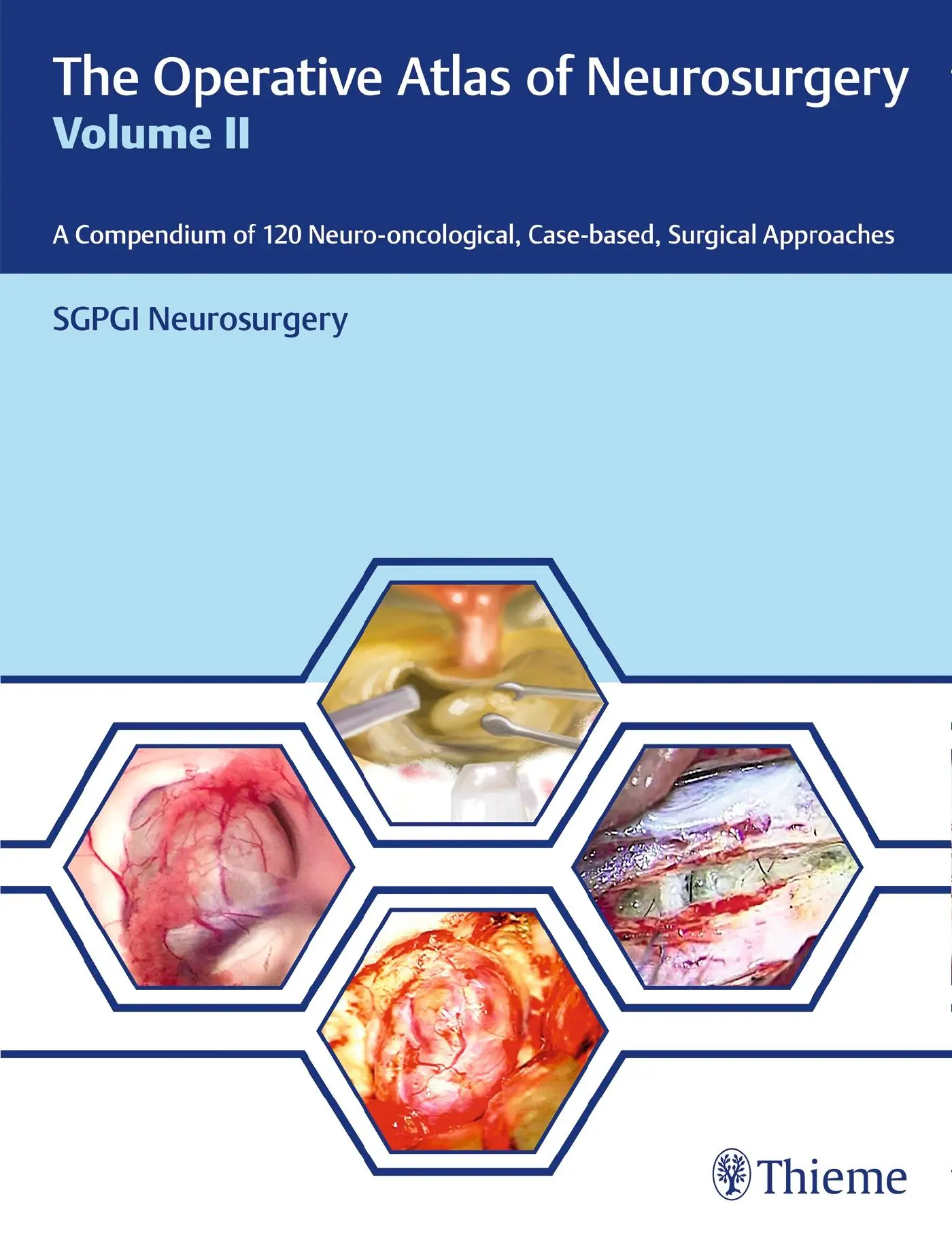 Cover: 9789388257923 | The Operative Atlas of Neurosurgery, Vol II | SGPGI Neurosurgery