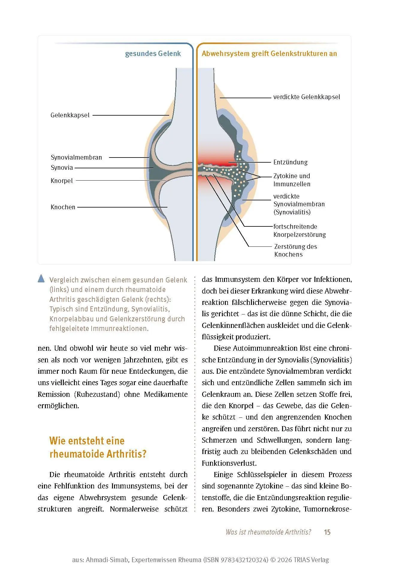 Bild: 9783432120324 | Expertenwissen: Rheuma | Keihan Ahmadi-Simab | Taschenbuch | 160 S.