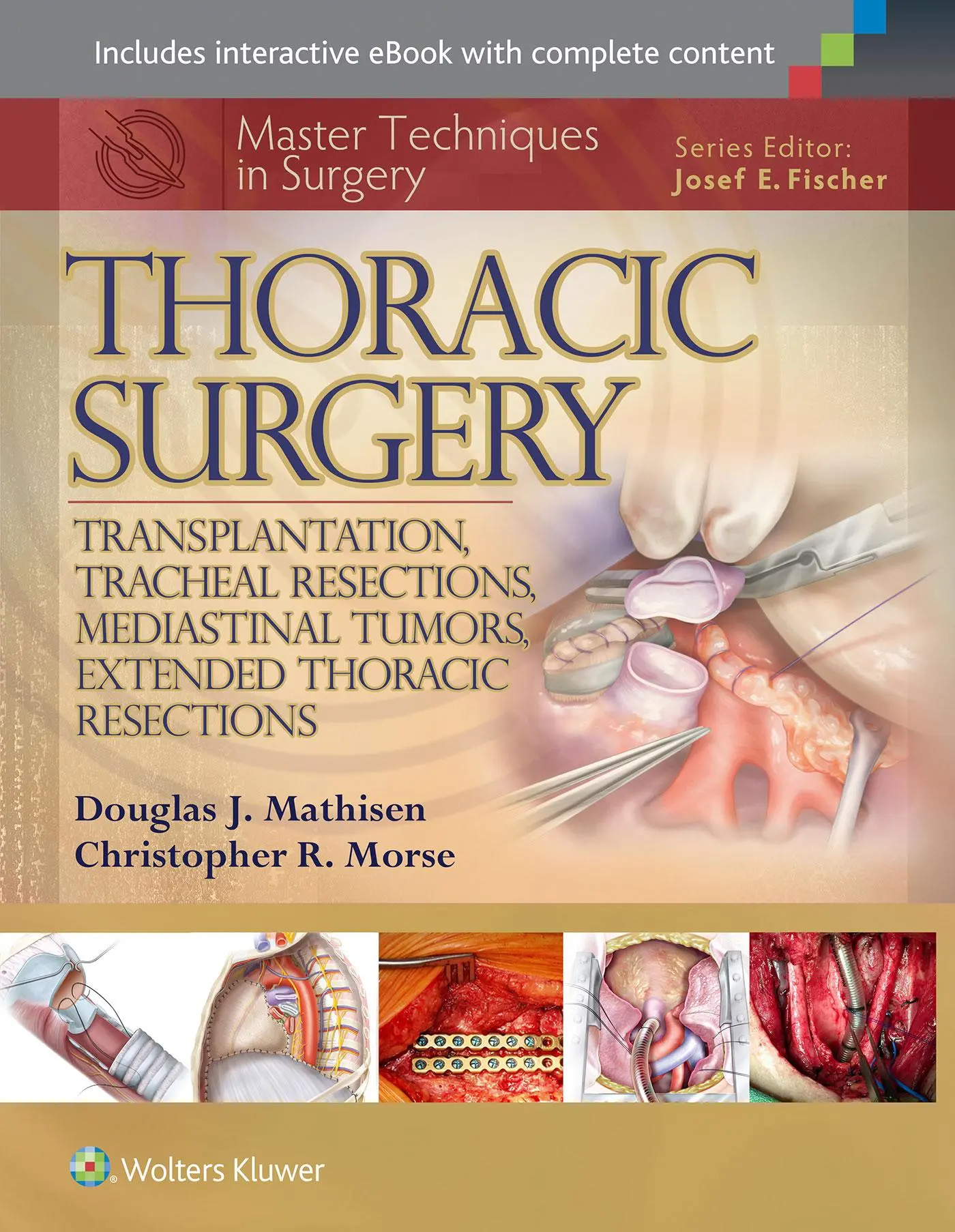 Cover: 9781451190724 | Master Techniques in Surgery: Thoracic Surgery: Transplantation,...
