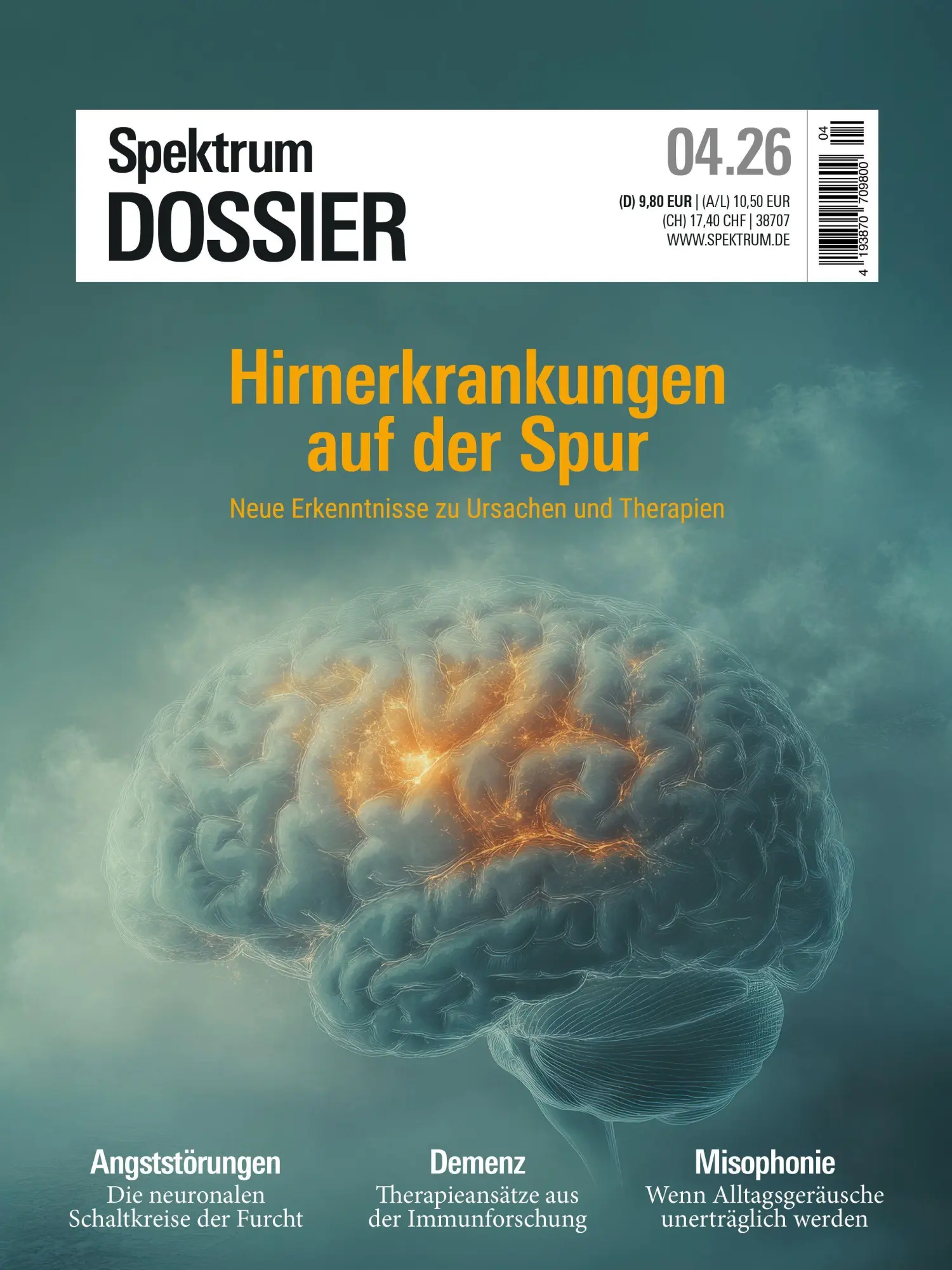 Cover: 9783690410724 | Spektrum Dossier 4/2026 Hirnerkrankungen auf der Spur | Wissenschaft