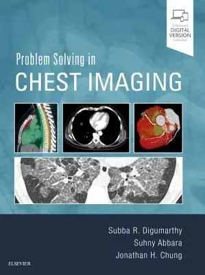 Cover: 9780323041324 | Problem Solving in Chest Imaging | Subba R Digumarthy (u. a.) | Buch
