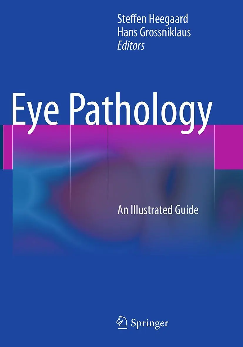 Cover: 9783662511824 | Eye Pathology | An Illustrated Guide | Steffen Heegaard (u. a.) | Buch Cover: 9783662511824 | Eye Pathology | An Illustrated Guide | Steffen Heegaard (u. a.) | Buch