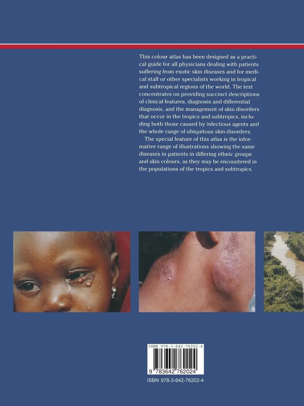 Rückseite: 9783642762024 | Colour Atlas of Tropical Dermatology and Venerology | Karl F. Schaller