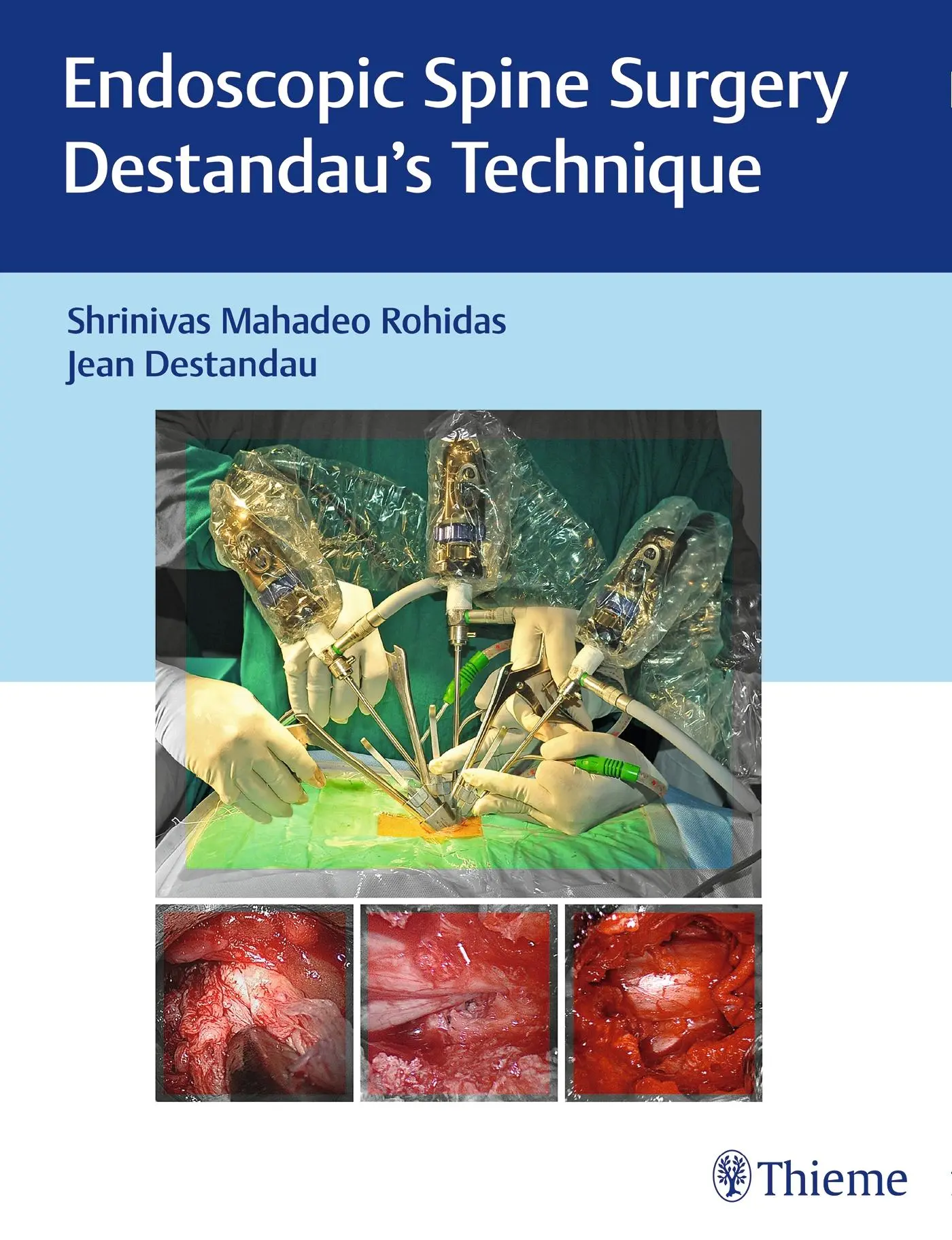 Cover: 9789385062124 | Endoscopic Spine Surgery | Destandau's Technique | Rohidas | Buch