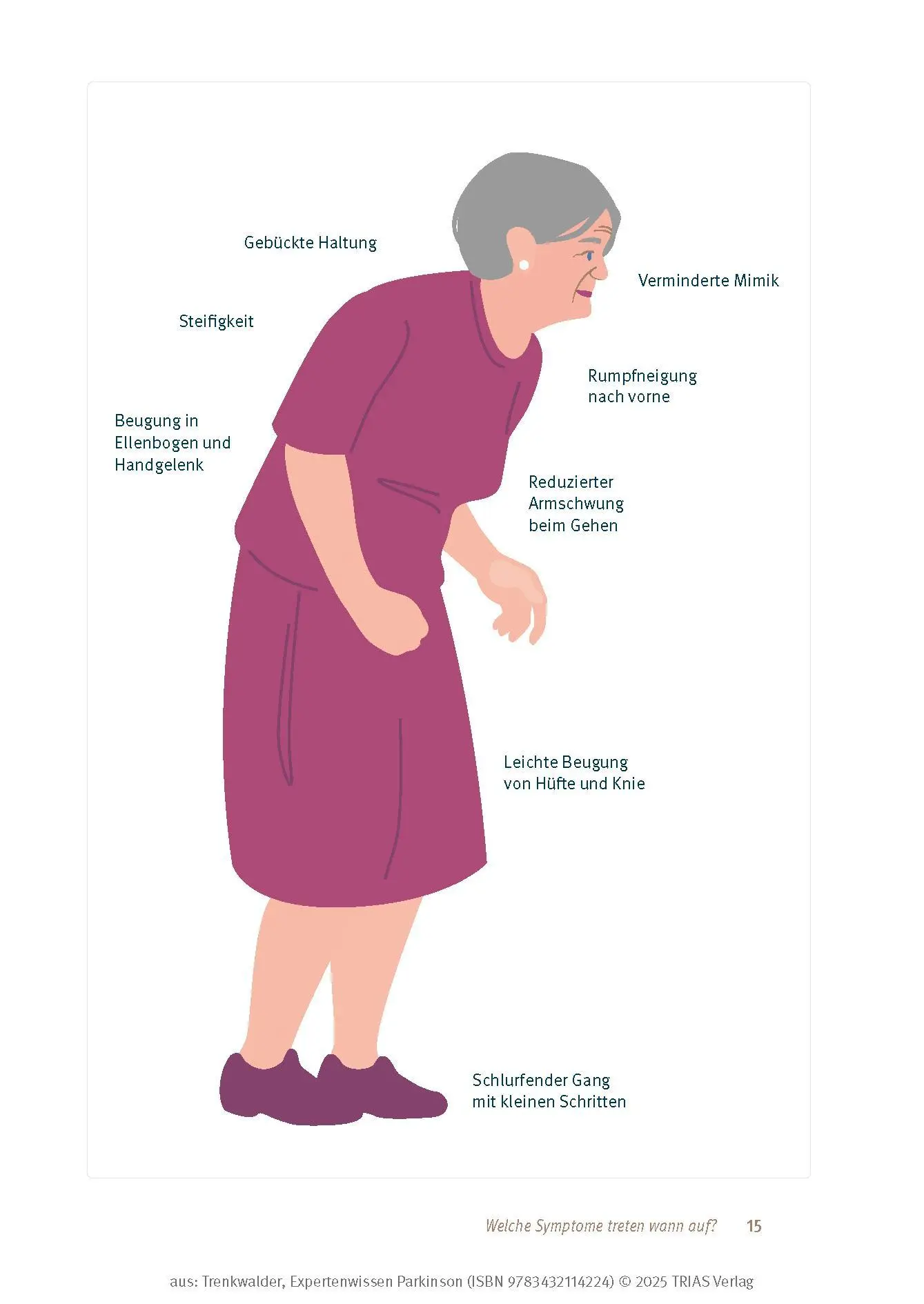 Bild: 9783432114224 | Expertenwissen: Parkinson | Claudia Trenkwalder | Taschenbuch | 208 S.