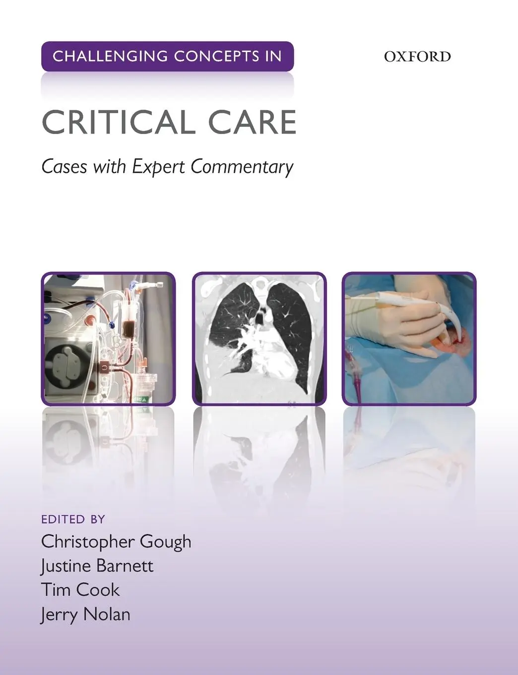 Cover: 9780198814924 | Challenging Concepts in Critical Care | Cases with Expert Commentary