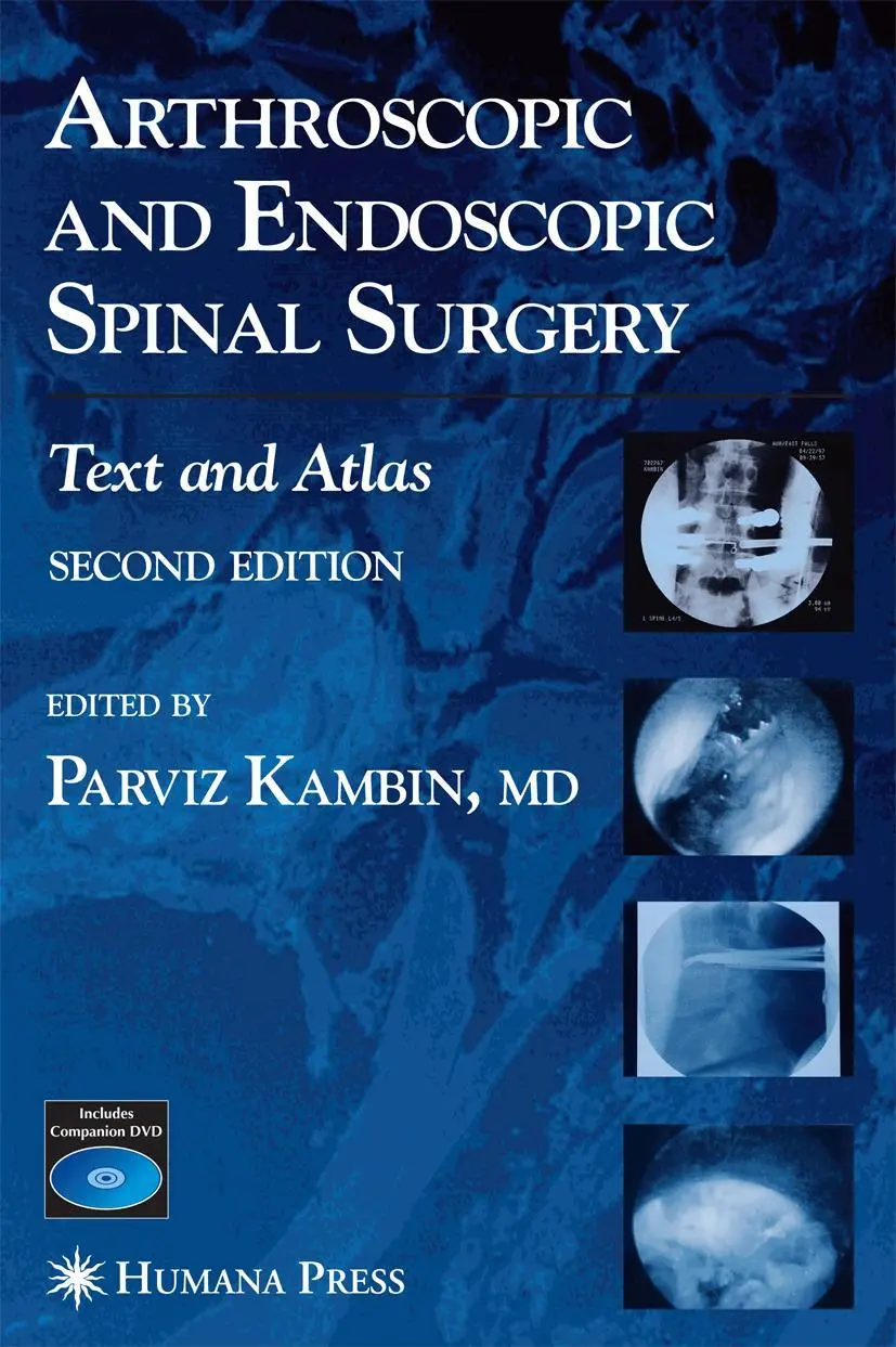 Cover: 9781588295224 | Arthroscopic and Endoscopic Spinal Surgery | Text and Atlas | Kambin