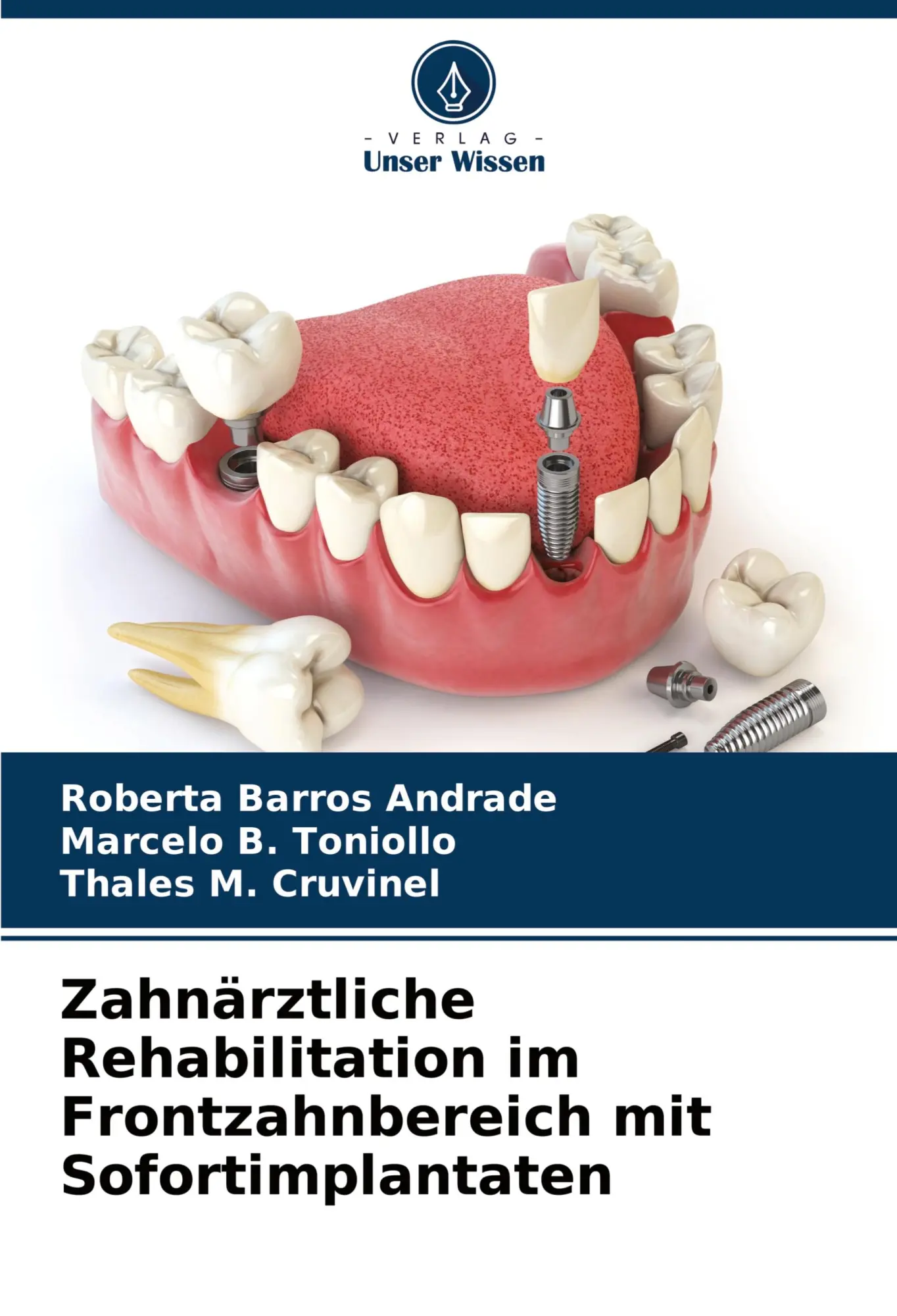 Cover: 9786207546824 | Zahnärztliche Rehabilitation im Frontzahnbereich mit Sofortimplantaten