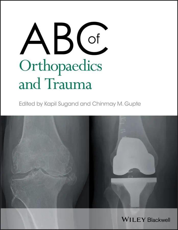 Cover: 9781118561225 | ABC of Orthopaedics and Trauma | Kapil Sugand (u. a.) | Taschenbuch