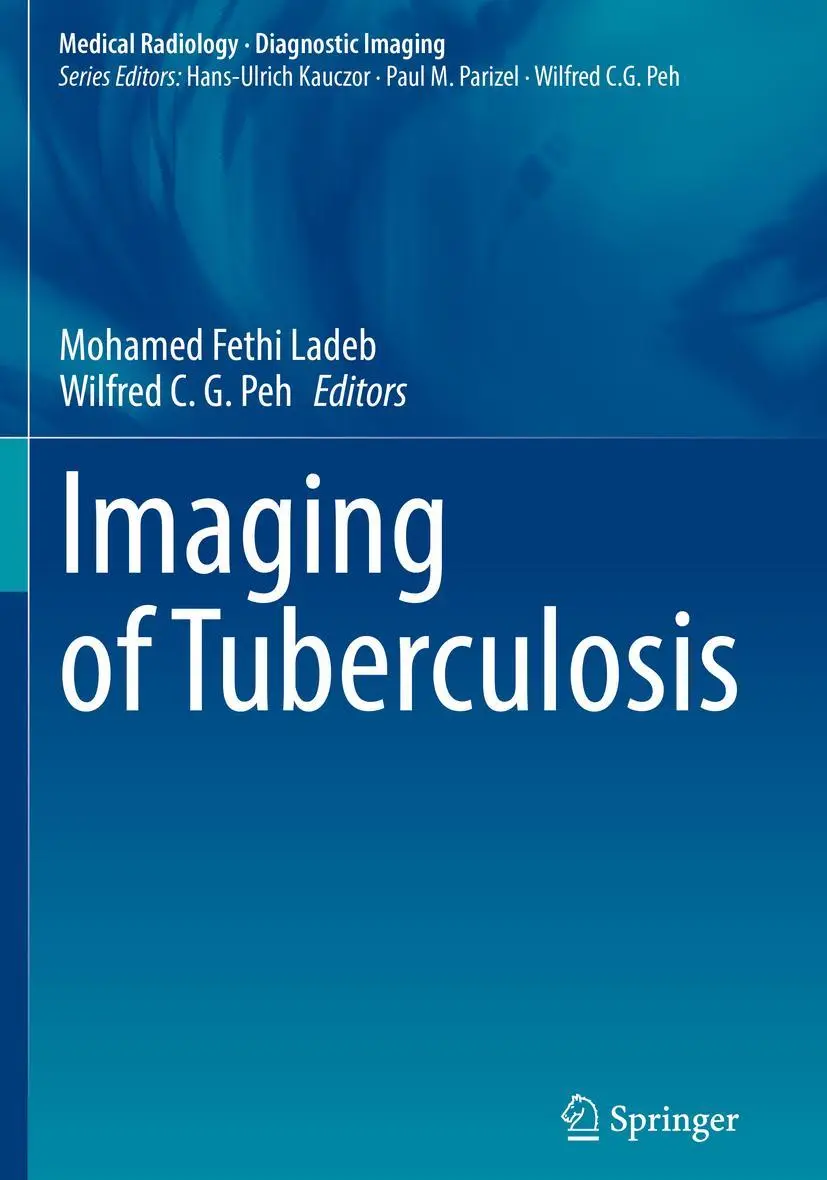 Cover: 9783031070426 | Imaging of Tuberculosis | Mohamed Fethi Ladeb (u. a.) | Taschenbuch