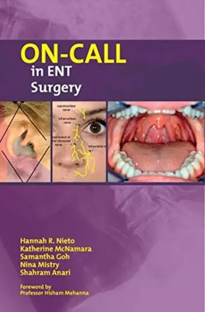 Cover: 9781911450726 | On-Call in ENT Surgery | Hannah Nieto (u. a.) | Taschenbuch | Englisch