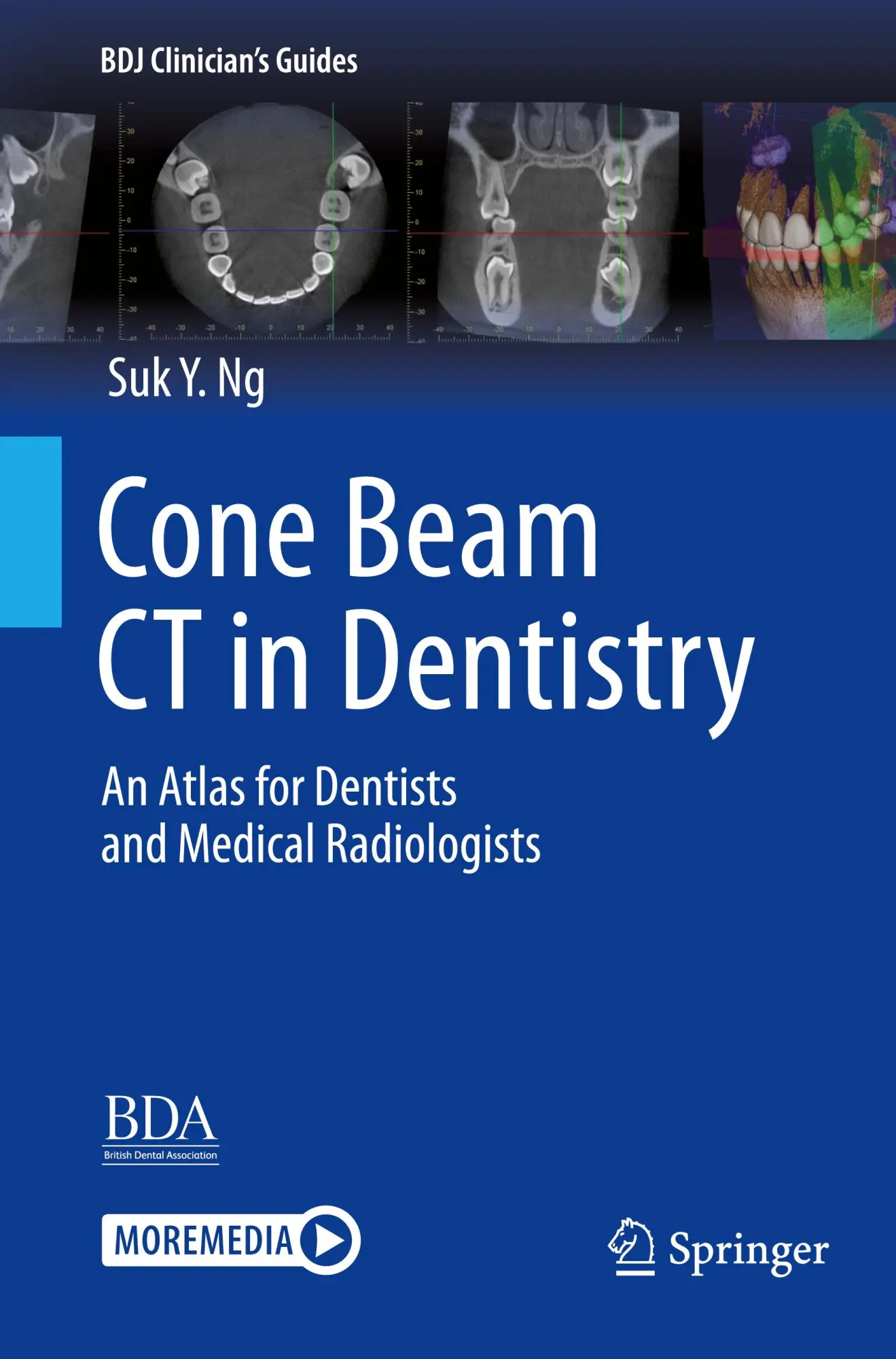Cover: 9783031254826 | Cone Beam CT in Dentistry | Suk Y. Ng | Taschenbuch | xv | Englisch