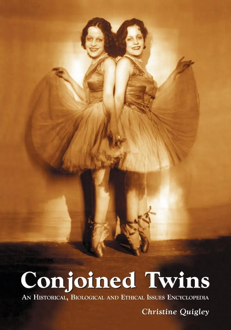 Cover: 9780786428526 | Conjoined Twins | Christine Quigley | Taschenbuch | Englisch | 2006
