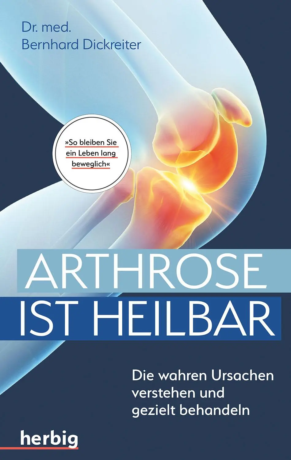Cover: 9783968590127 | Arthrose ist heilbar | Bernhard Dickreiter | Taschenbuch | 172 S.