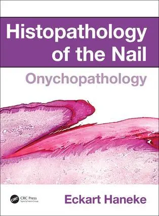 Cover: 9781482212327 | Histopathology of the Nail | Onychopathology | Eckart Haneke | Buch