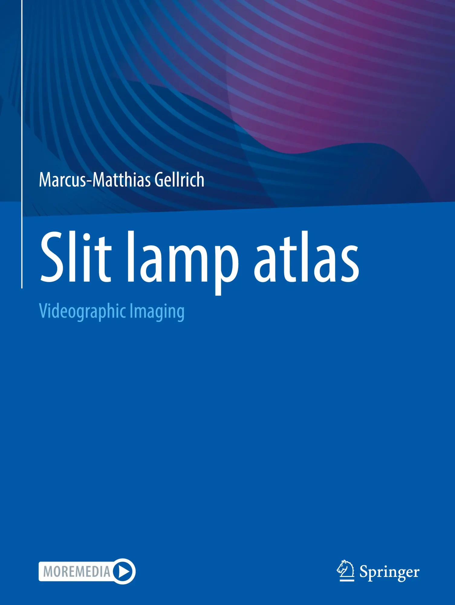 Cover: 9783662702727 | Slit lamp atlas | Videographic Imaging | Marcus-Matthias Gellrich