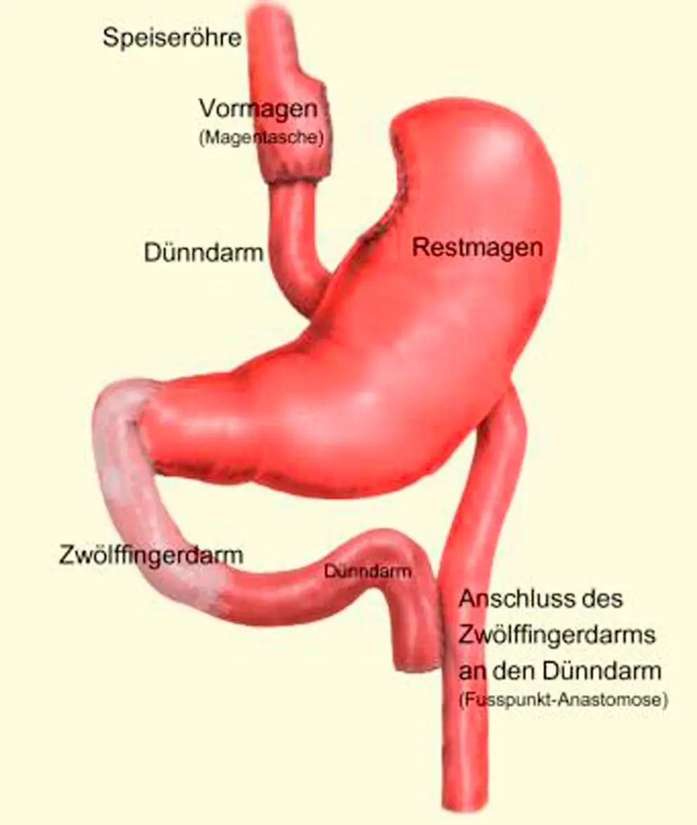 Bild: 9783944584027 | Endlich dünn! | Abschied von 75 ungeliebten Kilos | Iddings | Buch