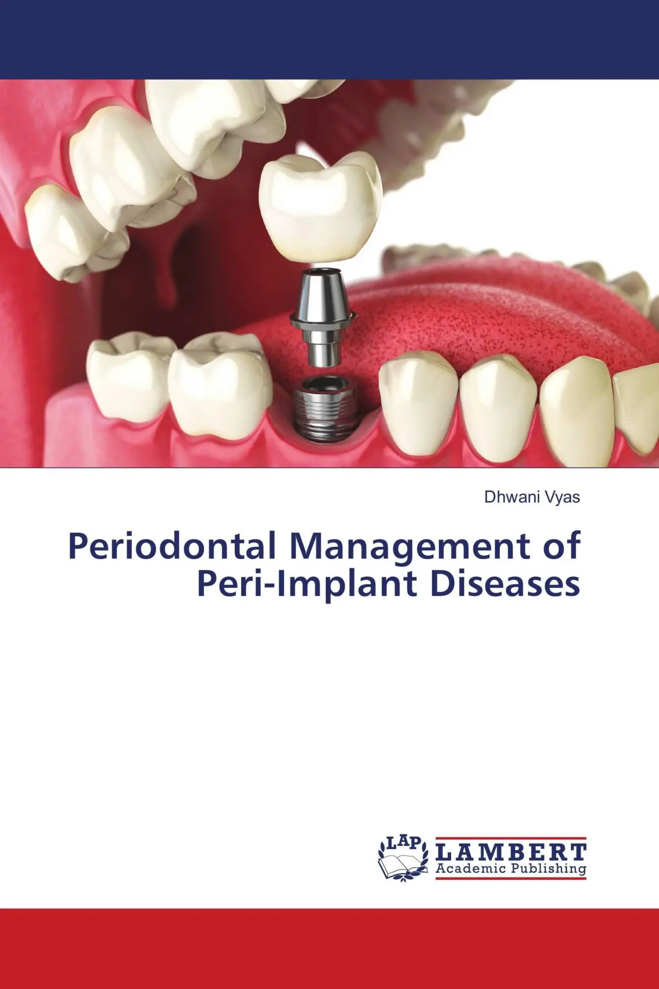 Periodontal Management of Peri-Implant Diseases