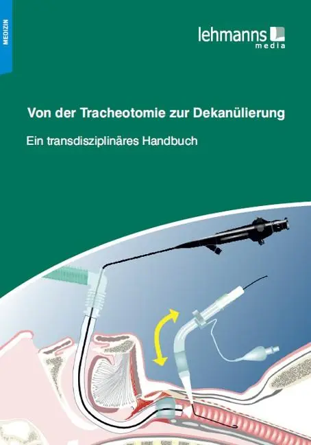 Cover: 9783865415127 | Von der Tracheotomie zur Dekanülierung | Beyer | Taschenbuch | 144 S.