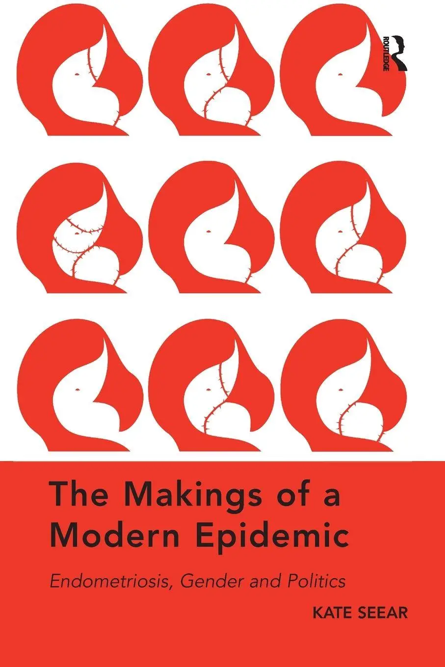 Cover: 9780367078027 | The Makings of a Modern Epidemic | Endometriosis, Gender and Politics