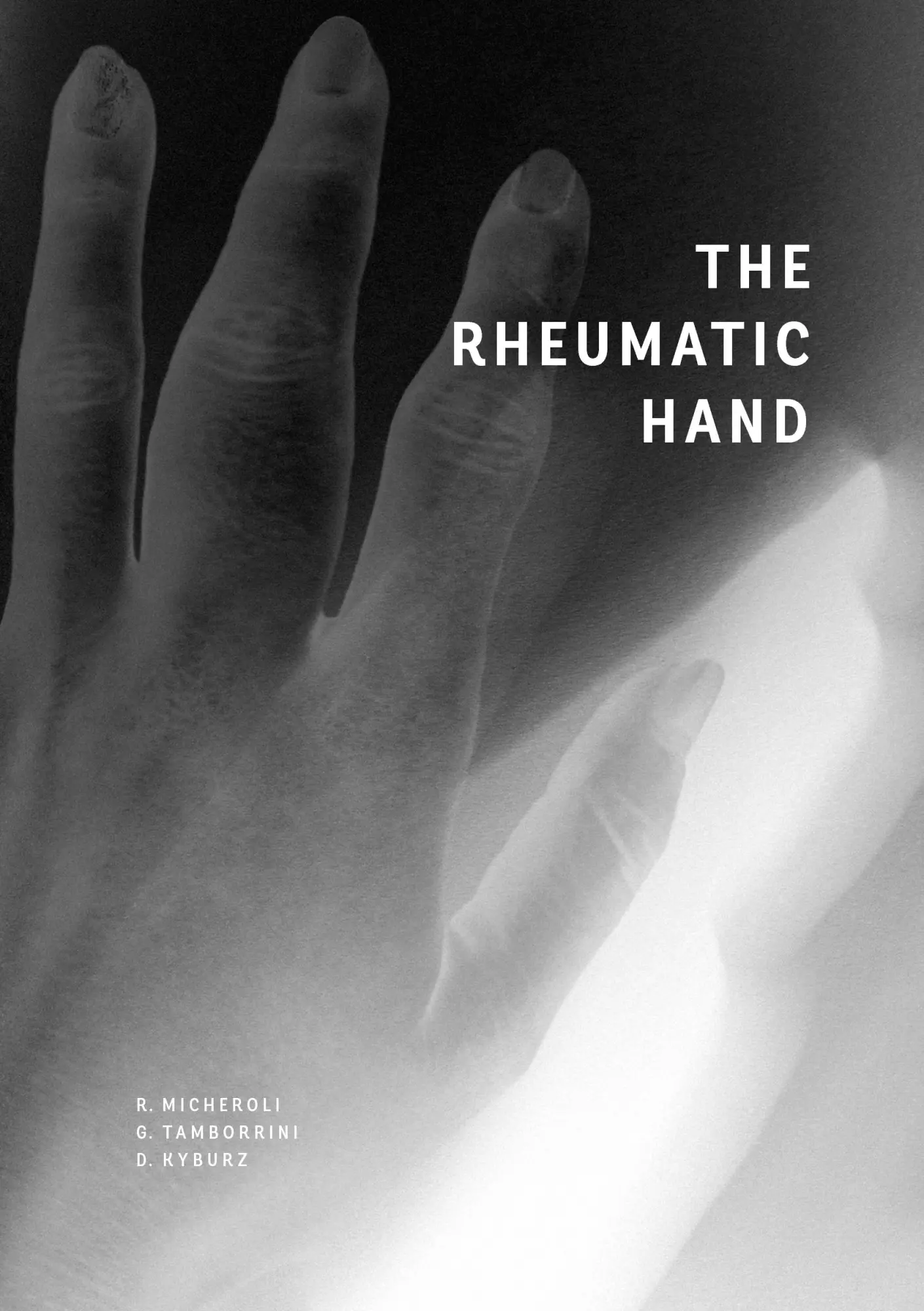 Cover: 9783734778827 | The Rheumatic Hand | Raphael Micheroli (u. a.) | Taschenbuch | 40 S.