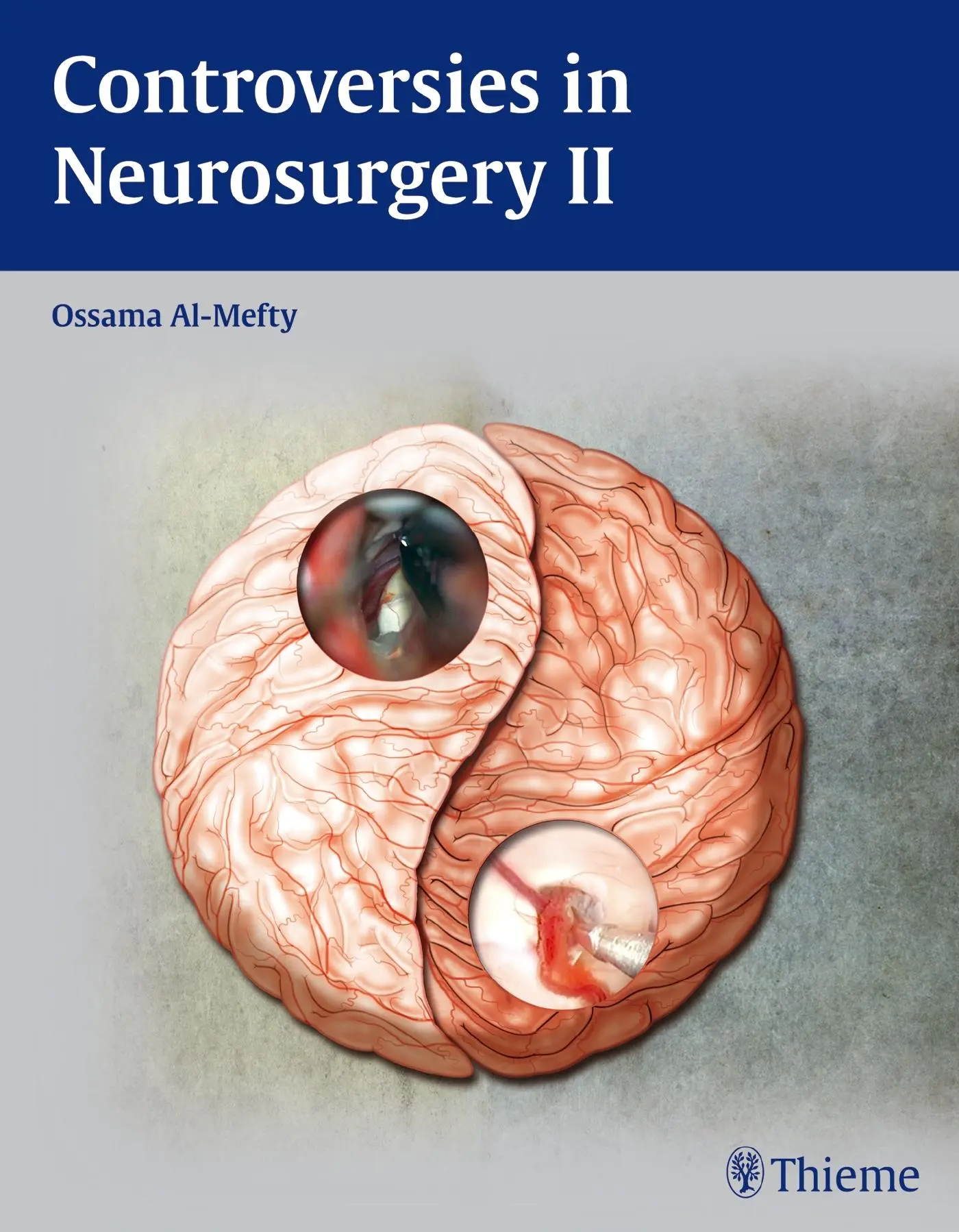 Cover: 9781604062328 | Controversies in Neurosurgery II | Ossama Al-Mefty | Buch | 464 S.