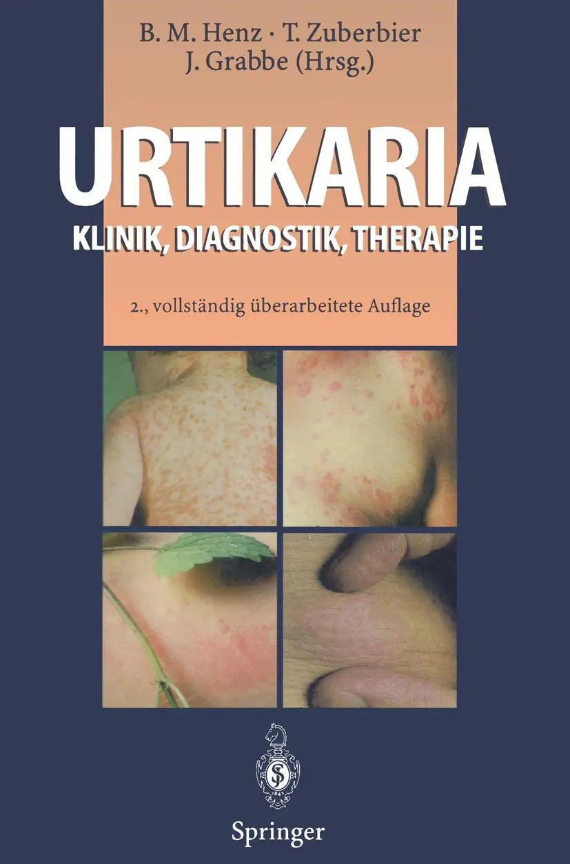 Cover: 9783642852428 | Urtikaria | Klinik, Diagnostik, Therapie | Beate M. Henz (u. a.) | xvi