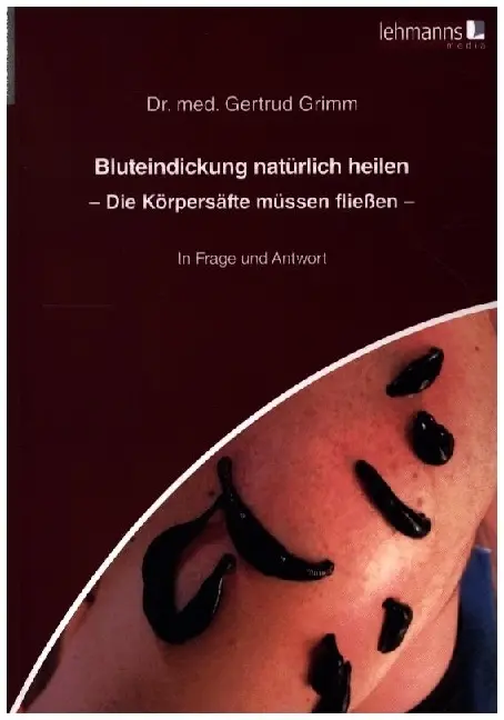 Cover: 9783965434028 | Bluteindickung natürlich heilen | Die Körpersäfte müssen fließen