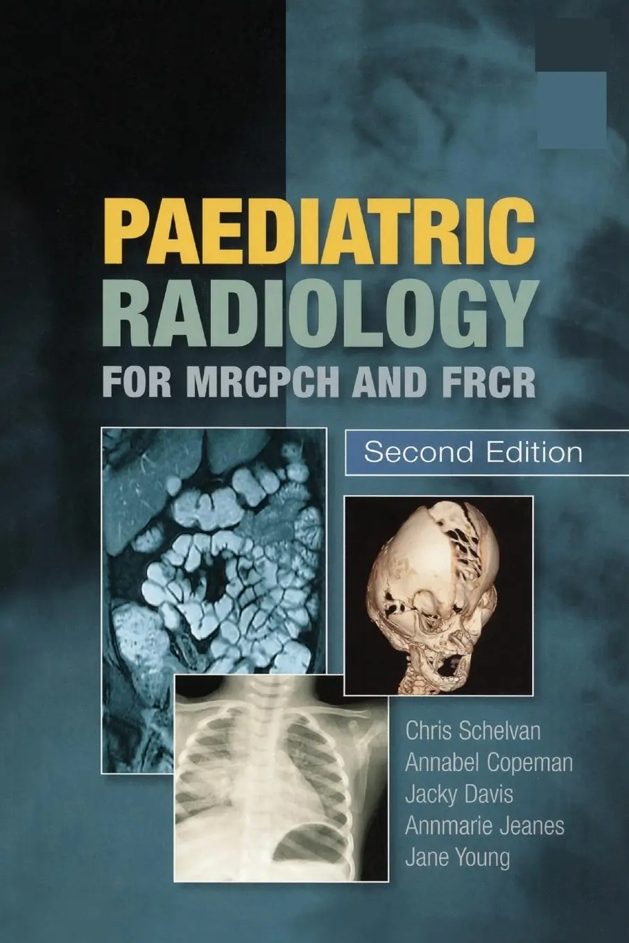Cover: 9781853157028 | Paediatric Radiology for MRCPCH and FRCR, Second Edition | Taschenbuch