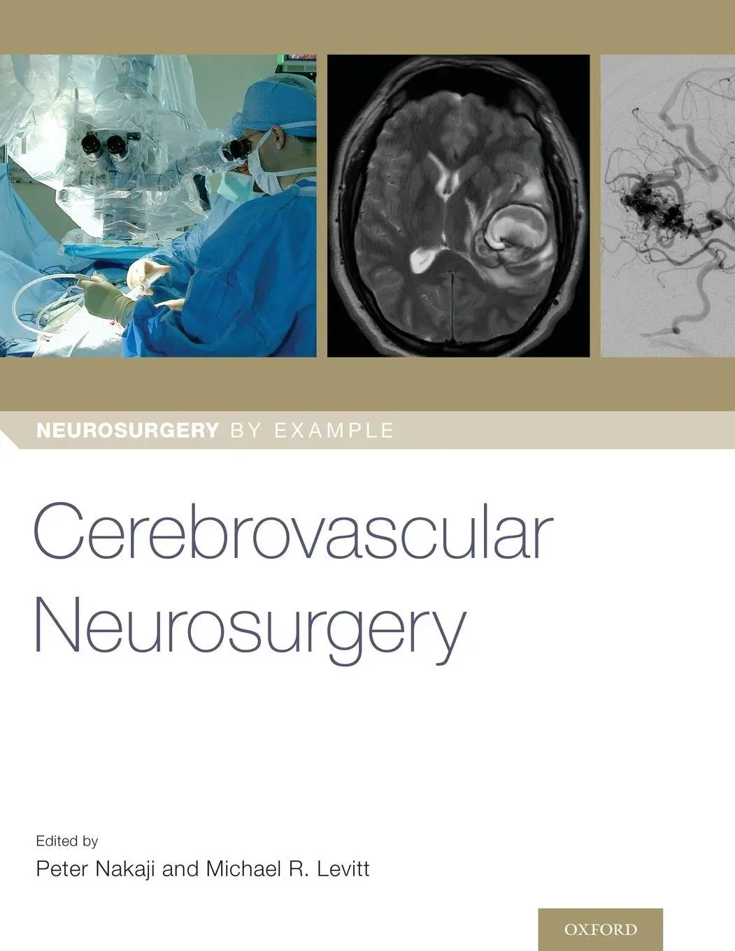 Cover: 9780190887728 | Cerebrovascular Neurosurgery | Peter Nakaji (u. a.) | Taschenbuch