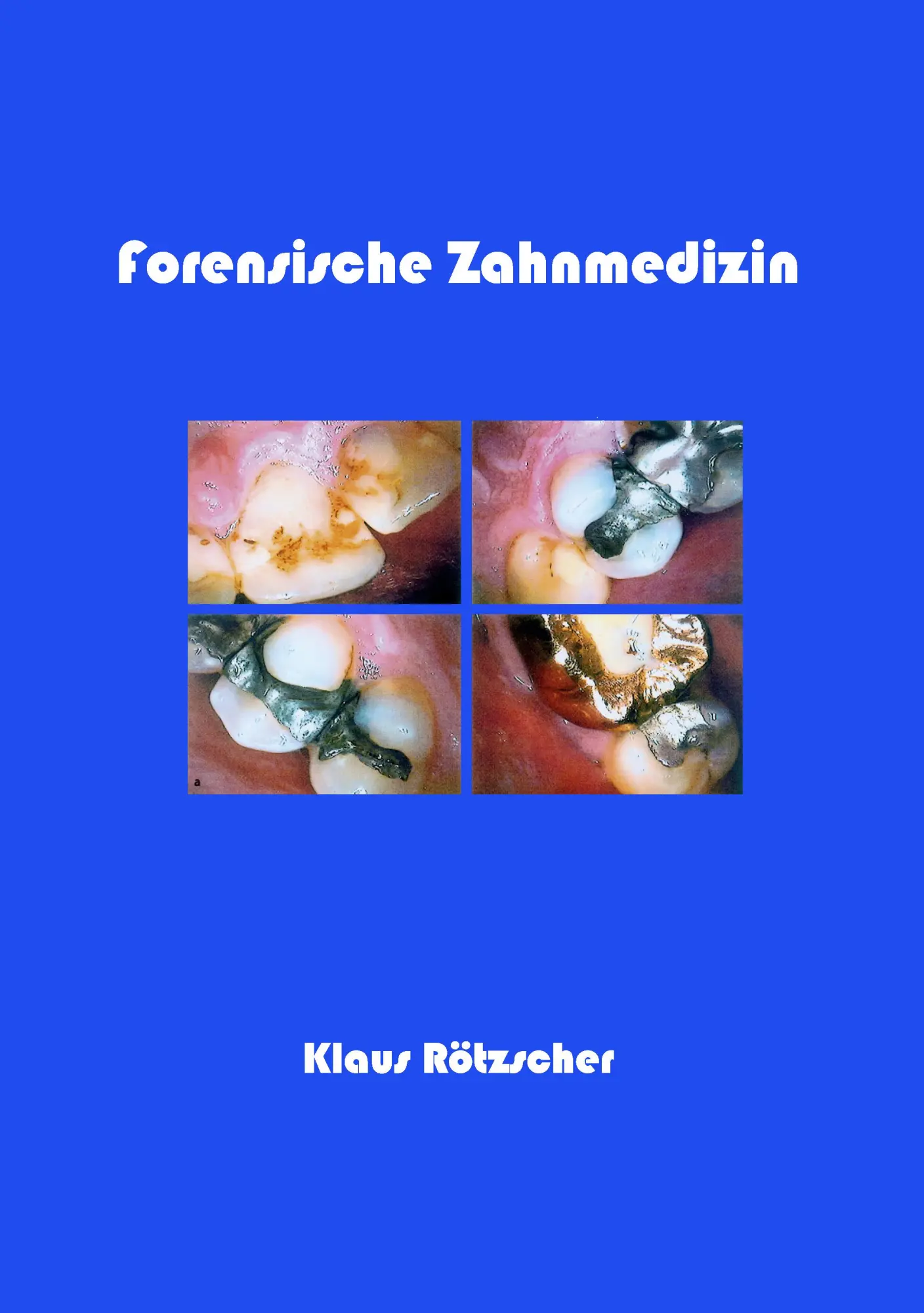 Cover: 9783833403729 | Forensische Zahnmedizin | Klaus Rötzscher | Taschenbuch | 262 S.
