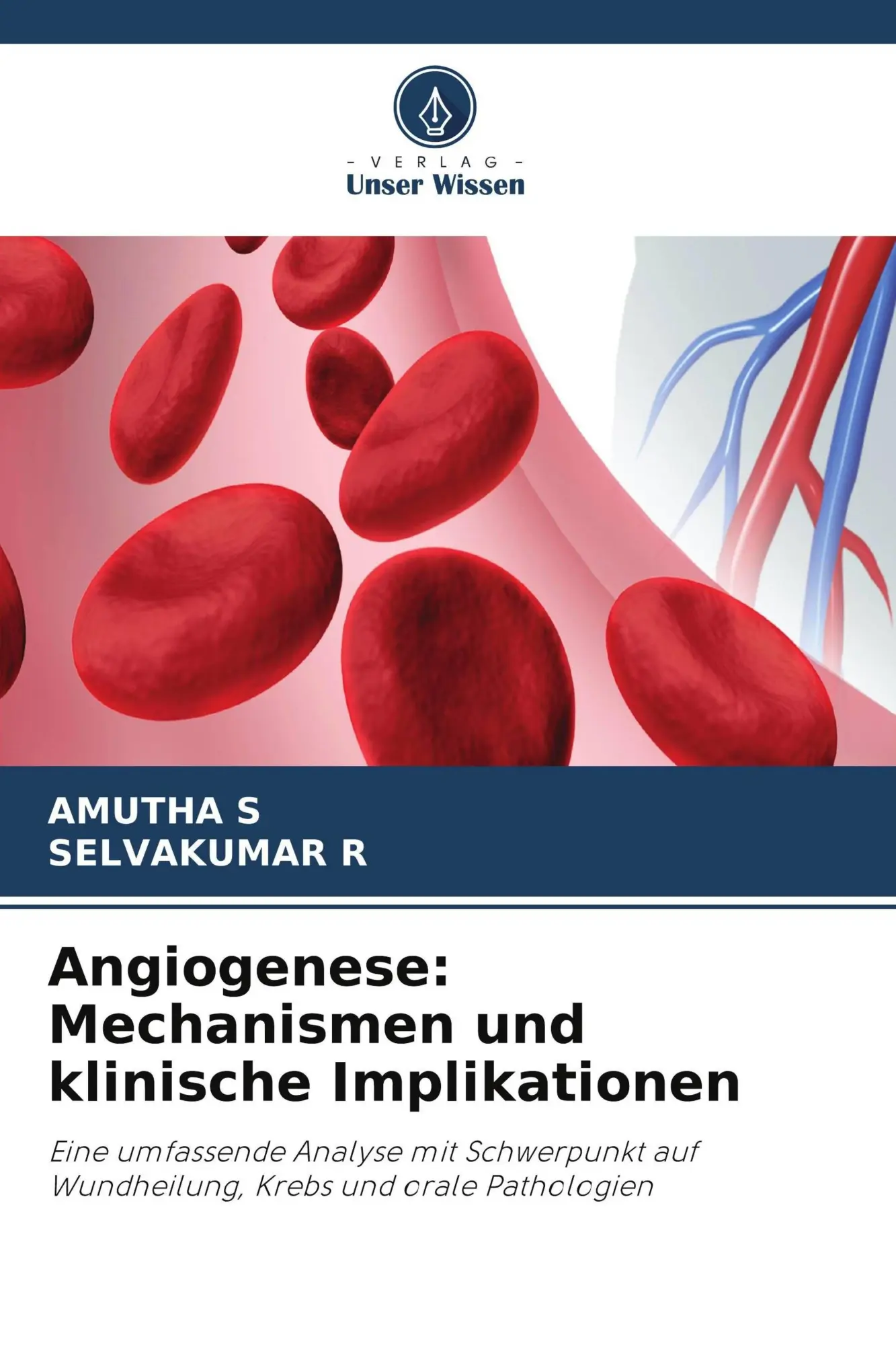 Cover: 9786630083729 | Angiogenese: Mechanismen und klinische Implikationen | S (u. a.)