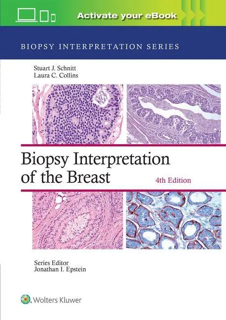 Cover: 9781975183929 | Biopsy Interpretation of the Breast: Print + eBook with Multimedia
